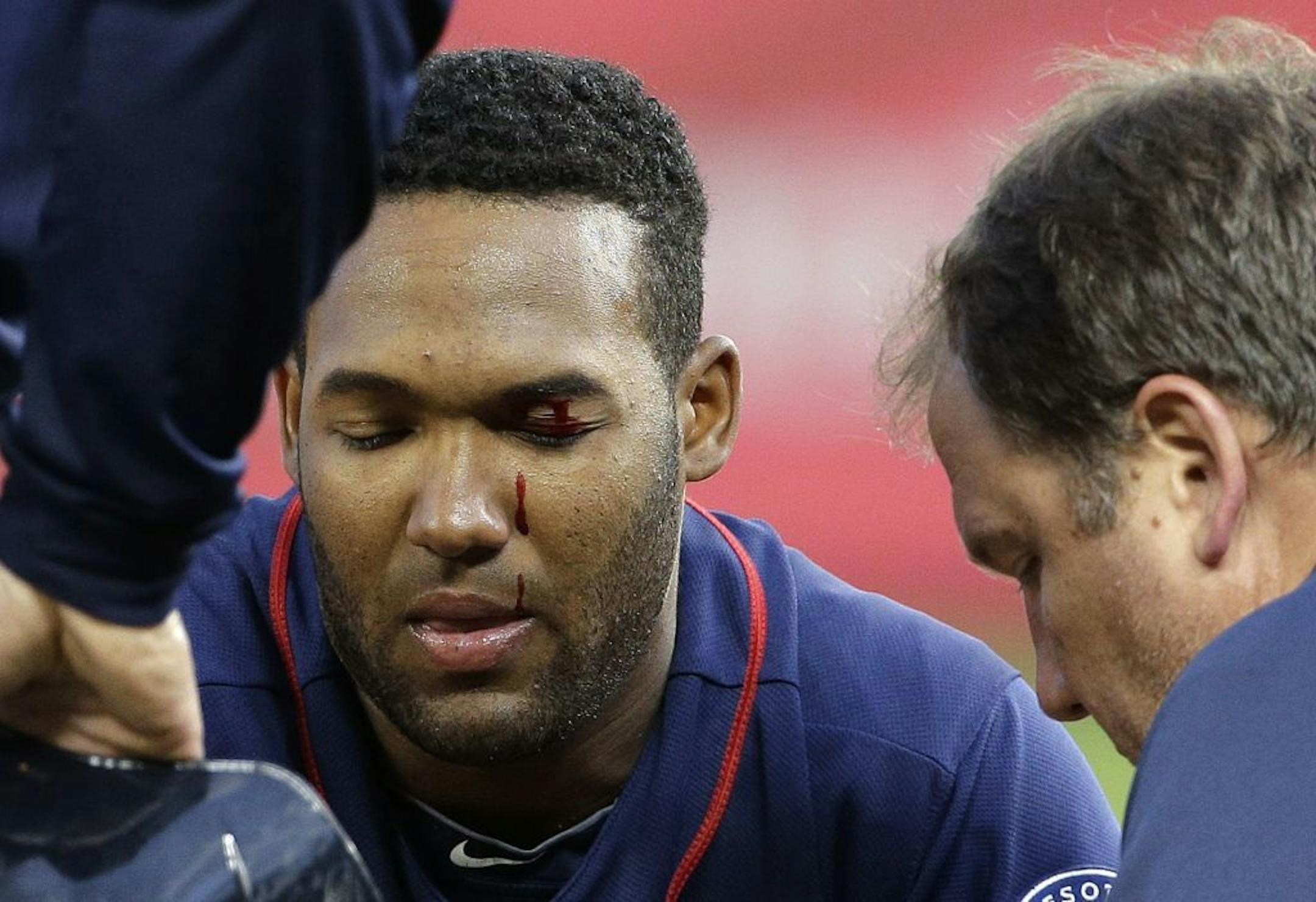 Minnesota Twins shortstop Danny Santana is treated by a trainer after cutting his eyelid while sliding into third base for a steal against the New York Yankees during the third inning of baseball game on Friday, May 30, 2014, in New York.