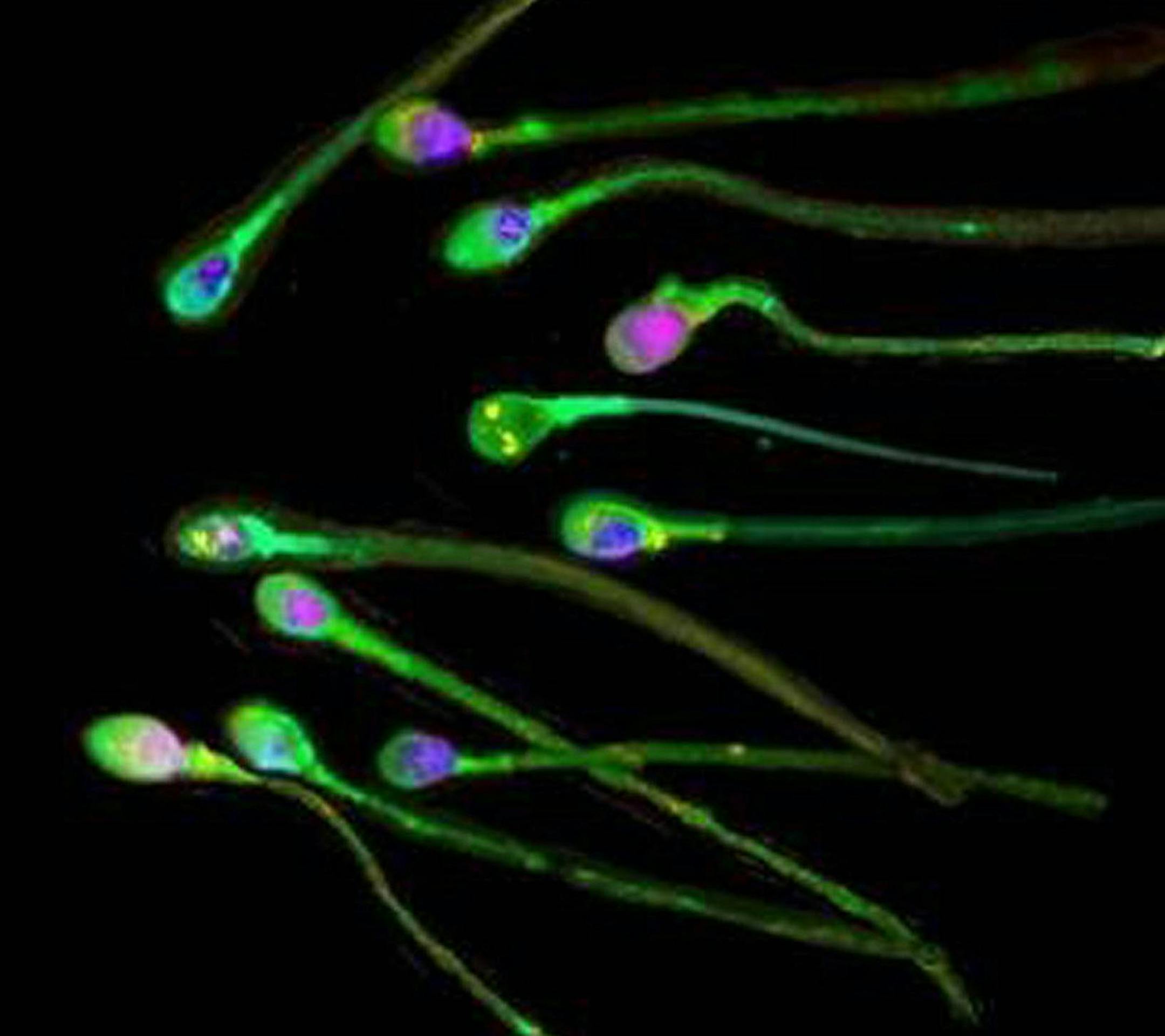 EMBARGOED UNTIL 19:00 GMT THURSDAY MARCH 27, 2003. This a a handout image from The Journal of Science of human sperm which may 'sniff' their way to the egg during fertilisation, according to new research reported, Thursday March 27, 2003. If the findings are confirmed it could lead to better IVF techniques and new methods of contraception. German and US scientists discovered a smell receptor molecule on the surface of human sperm cells, similar to those in the nose. (AP Photo/PA, Journal of Scie