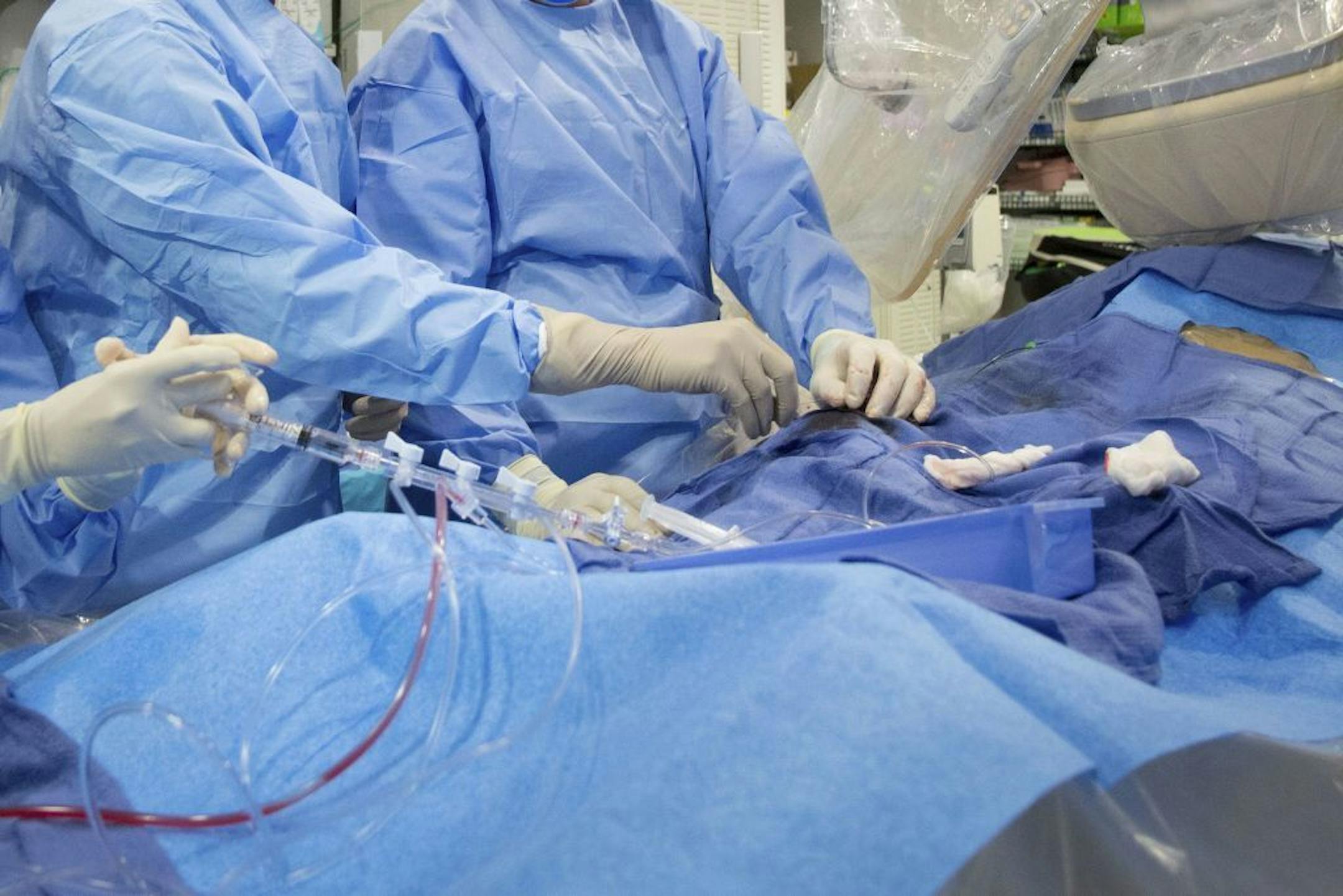 In this Feb. 16, 2017 file photo, surgeons perform a non-emergency angioplasty at Mount Sinai Hospital in New York. Through a blood vessel in the groin, a tube is guided to a blockage in the heart. A tiny balloon is then inflated to flatten the clog, and a mesh tube called a stent is inserted to prop the artery open. According to a federally funded study released on Saturday, Nov. 16, 2019, people with severe but stable heart disease from clogged arteries may have less chest pain if they get a p