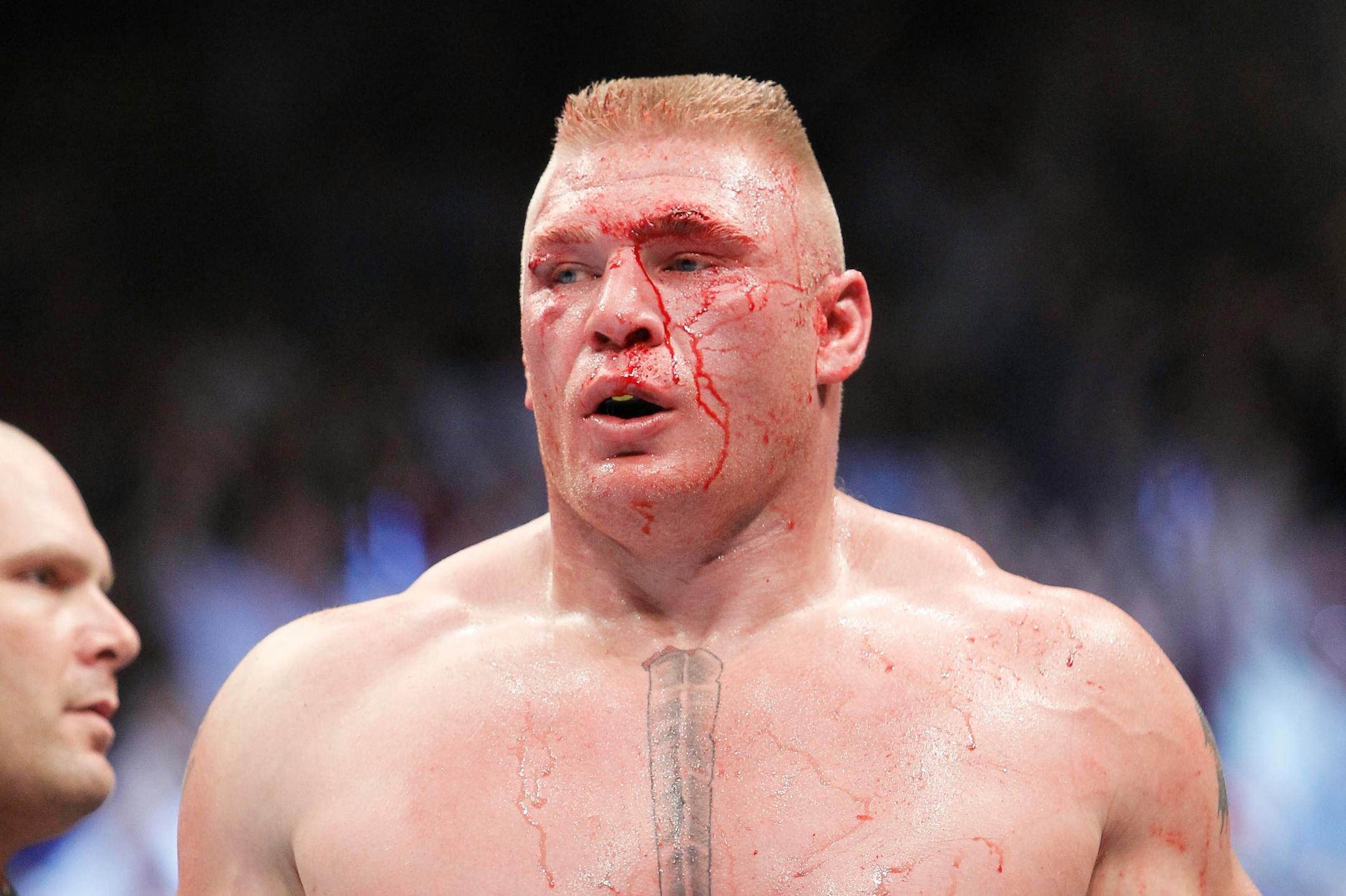 Brock Lesnar