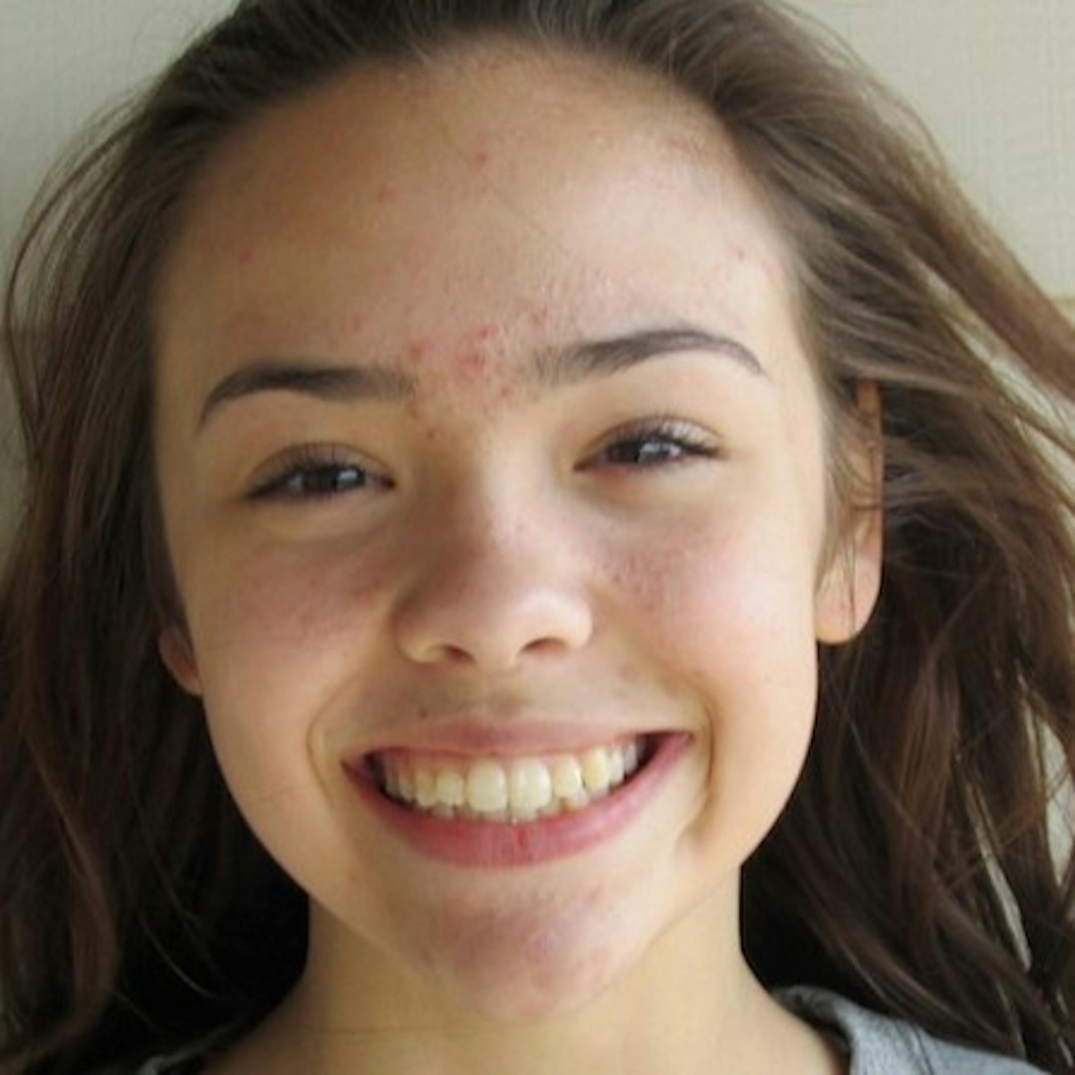 Josie Kropp, Prior Lake girls' lacrosse