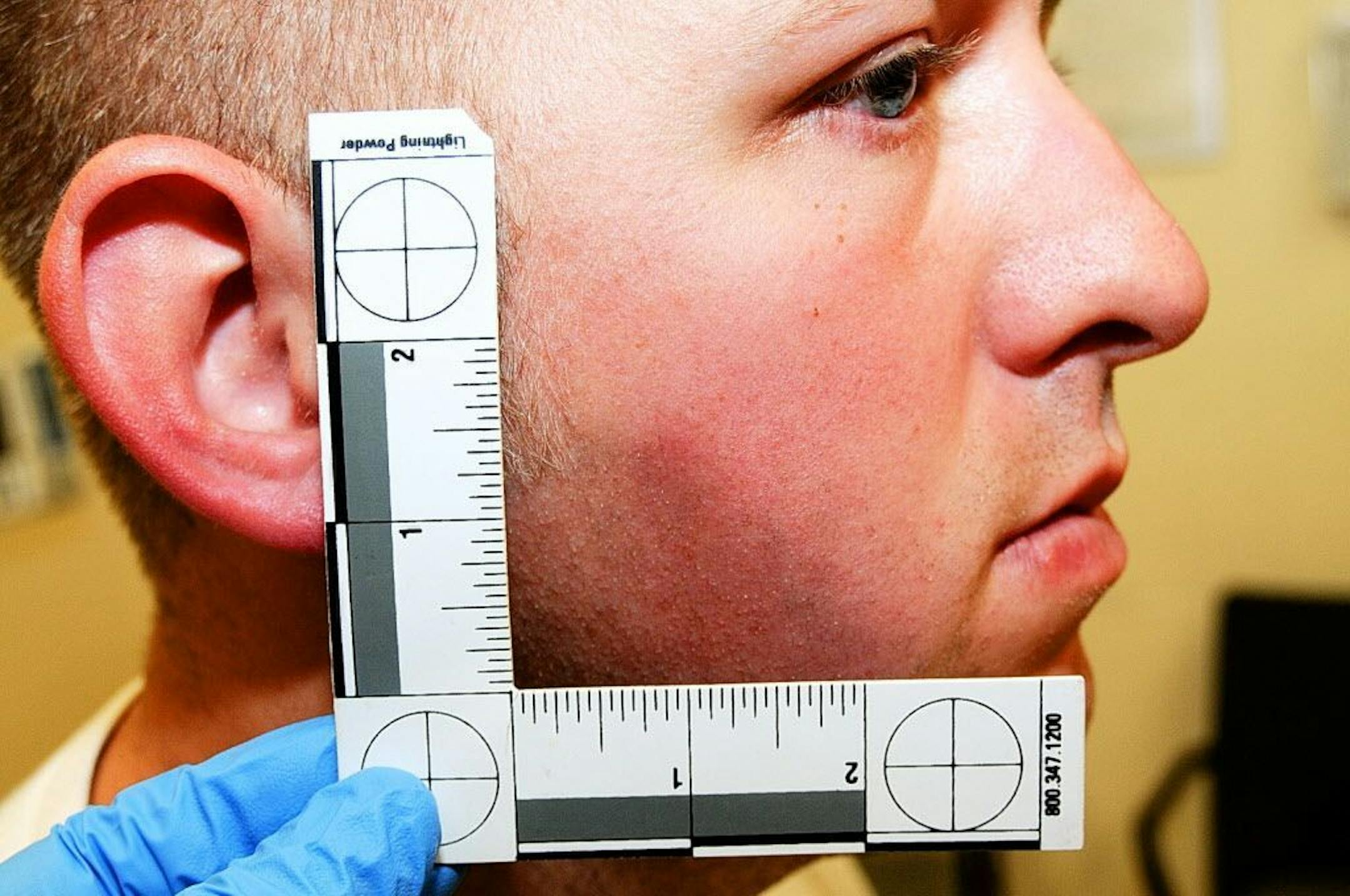 This undated photo released by the St. Louis County Prosecuting Attorney's office on Monday, Nov. 24, 2014, shows Ferguson police officer Darren Wilson during his medical examination.