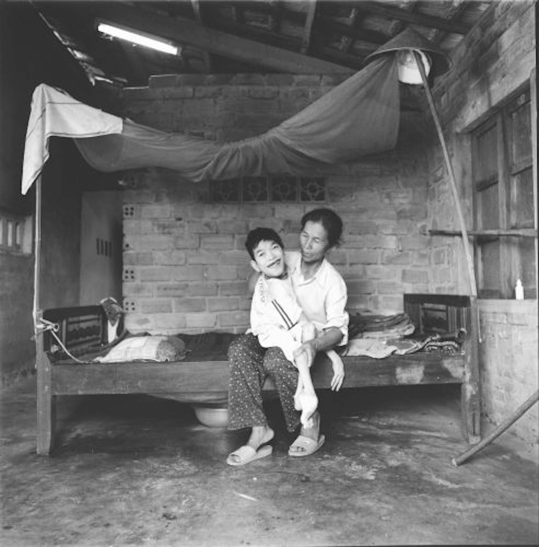 Nguyen Duc Tru, held by his mother, was 24 years old when photographed last year.