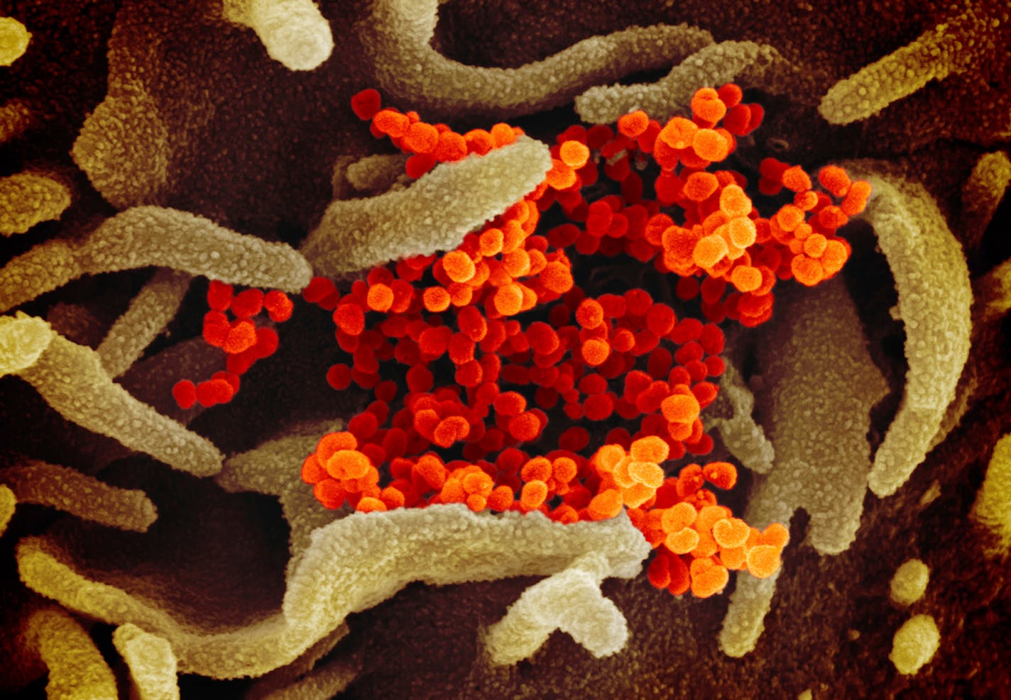 This electron microscope image made available by the U.S. National Institutes of Health shows the Novel Coronavirus SARS-CoV-2, in orange, emerging from the surface of cells, in green, cultured in the lab.