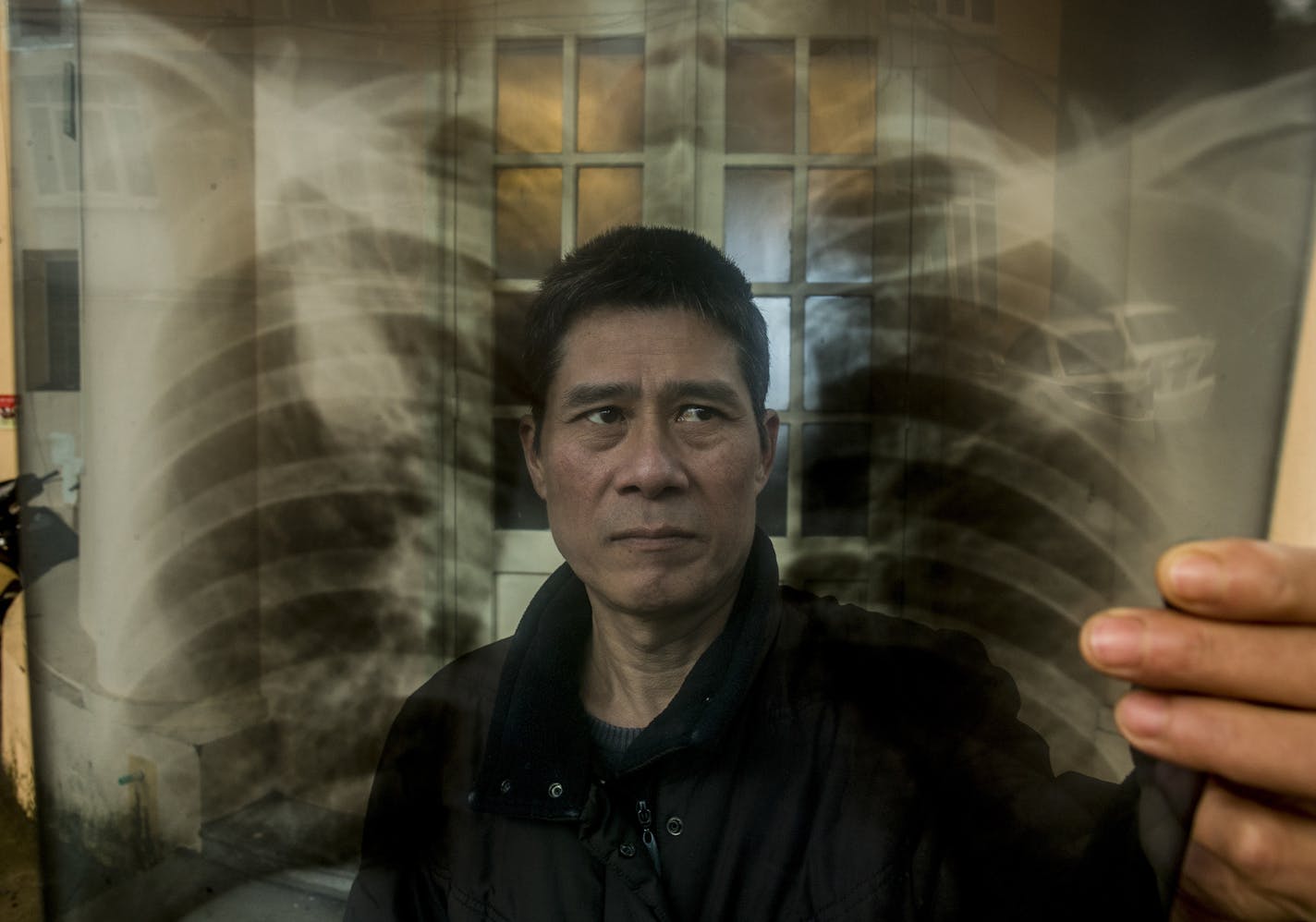 Nguyen Quang Thieu waits to have his lung X-ray examined by Dr. Hoang Thi Phuong, head of the respiratory tuberculosis department at the National Lung Hospital in Hanoi, Vietnam, Jan. 27, 2016. The country&#x2019;s stunning progress against deadly tuberculosis is being threatened by reduced funding for a health care system stretched thin. (Justin Mott/The New York Times)