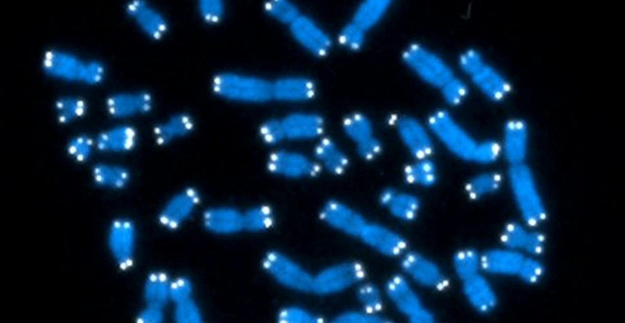 Human chromosomes, where DNA resides and does its work.