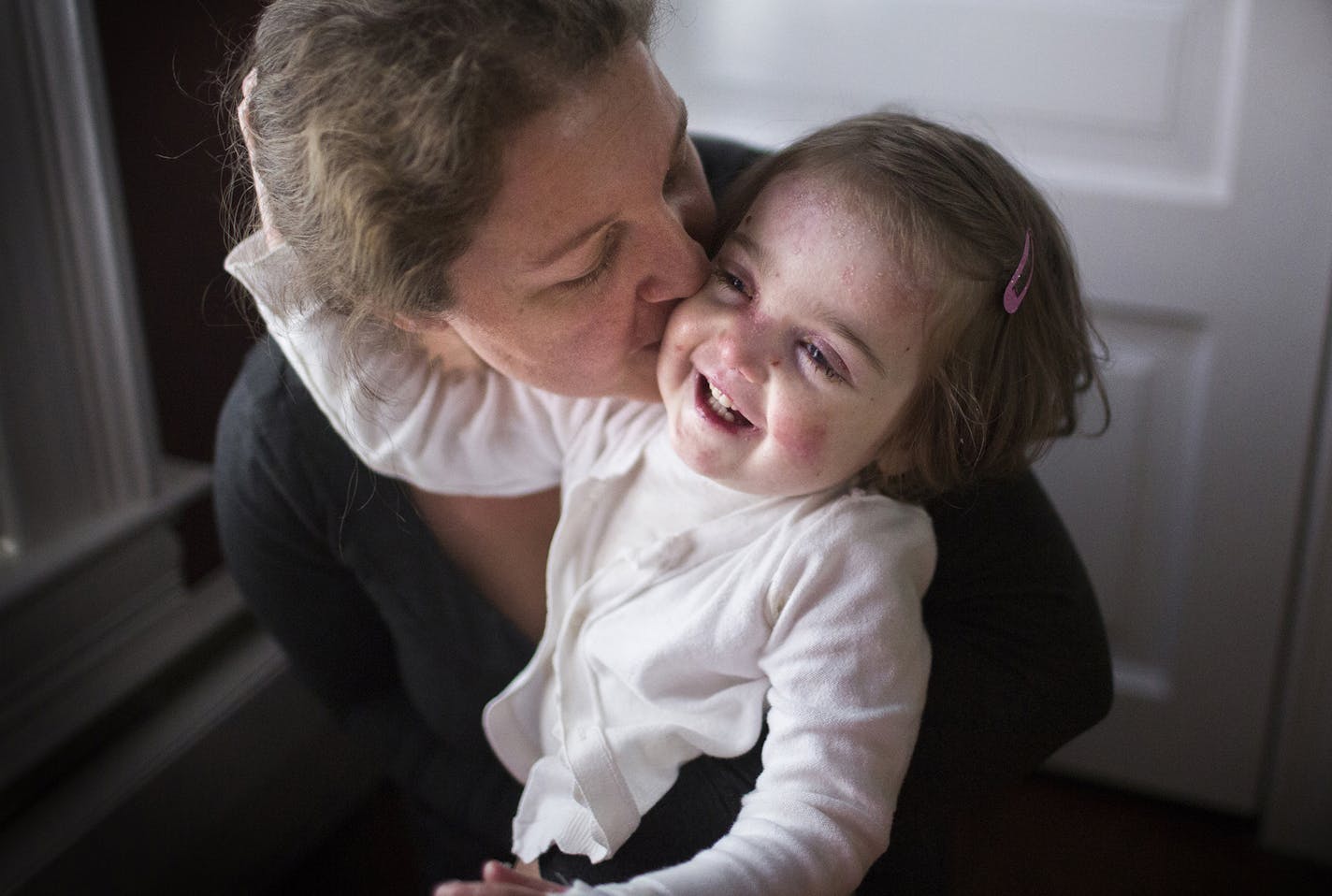 Elisa McCann, 2, plays with her mother Gabriella in their St. Paul home on Tuesday, October 6, 2015. ] LEILA NAVIDI leila.navidi@startribune.com / BACKGROUND INFORMATION: 2-year-old Elisa McCann was born with a genetic condition, epidermolysis bullosa, that causes her skin to blister and sluff off at the slightest contact. It's like having third-degree burns all over your body and drugs like oxycodone and morphine are not good long term solutions to manage her pain. Her mother, Gabriella McCann,