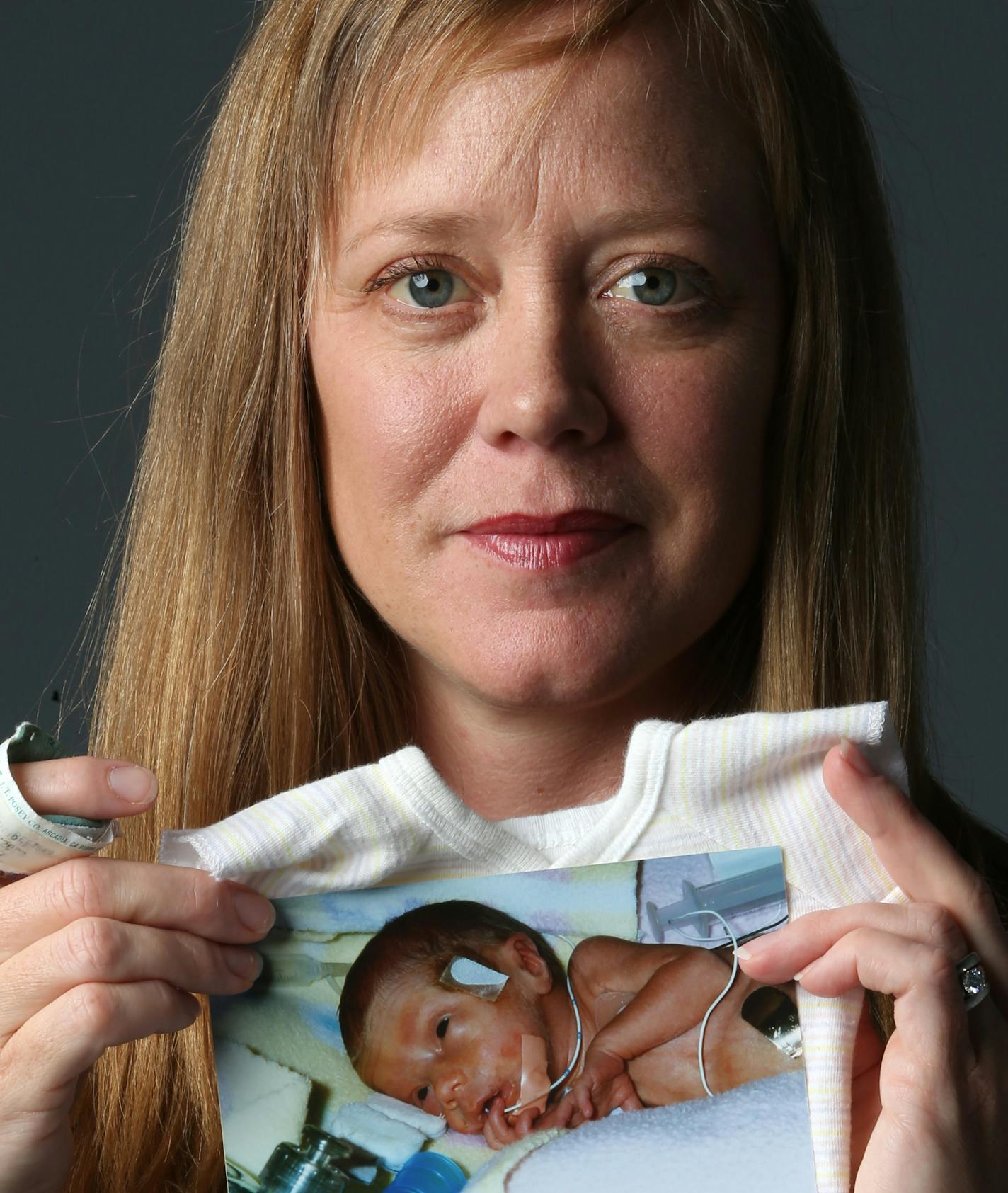 Kate Hopper, Author of "Ready for Air," a memoir about being diagnosed with preeclampsia and giving birth to a premature baby, held items from when her daughter, Stella was born premature, ten years ago. A story about Kate Hopper and Kevin Fenton, two writers who graduated from the same U of M MFA program in 2005 and now have memoirs out this fall with U of M Press and Hist Society Press. Both are following their passions, writing about something they love.] Bruce Bisping/Star Tribune bbisping@s