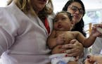 A child born with microcephaly caused by the Zika virus during an evaluation last September in Recife, Brazil.