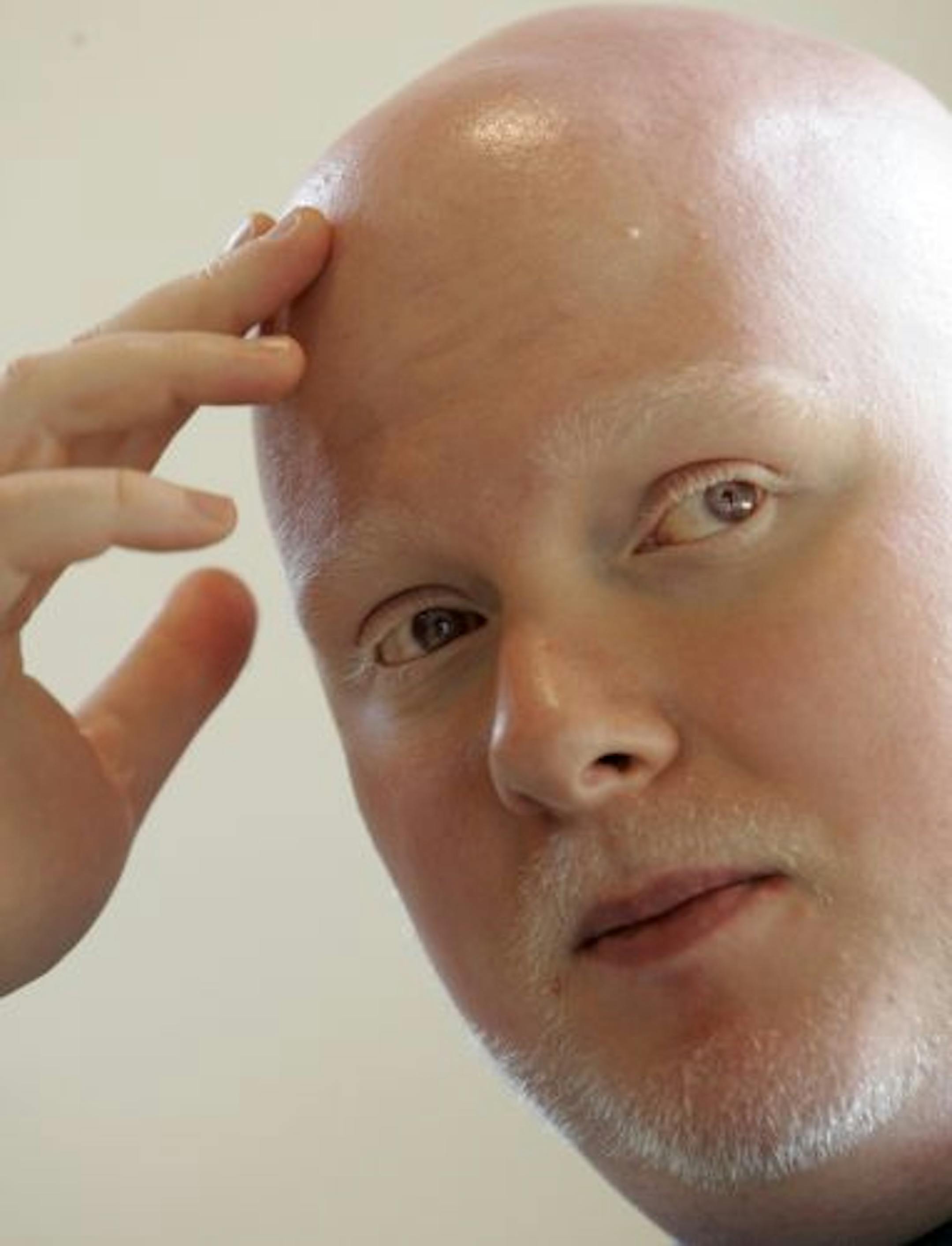 Brother Ali is shown during an interview at Rhymesayers offices in Minneapolis, Wednesday, June 13, 2007.