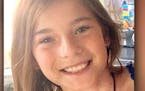 Maren Kesselhon, 11, was bitten while dangling from a paddle board on Island Lake north of Duluth.
