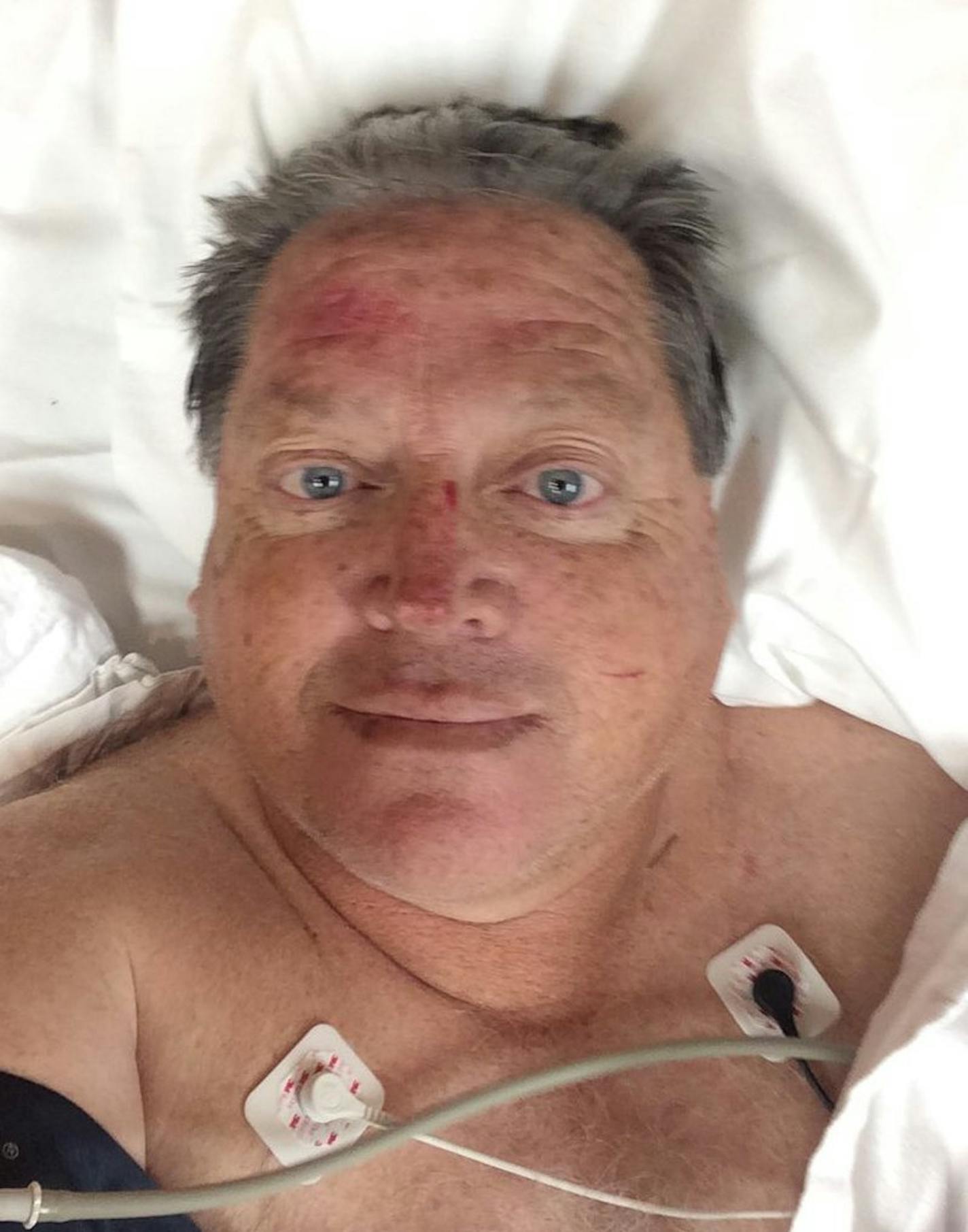 Tim Droogsma tweeted this post-crash self-portrait.