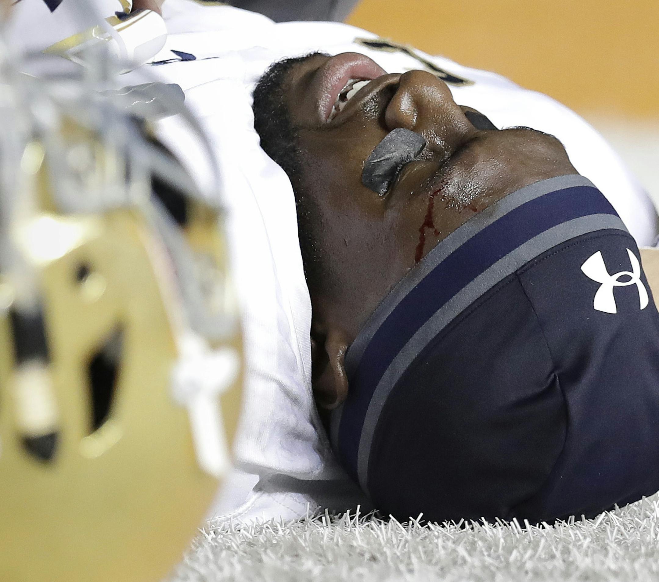Notre Dame wide receiver Torii Hunter Jr. (16) lies on the turf after he was injured during a play during the second half of an NCAA college football game against Texas, Sunday, Sept. 4, 2016, in Austin, Texas. (AP Photo/Eric Gay)