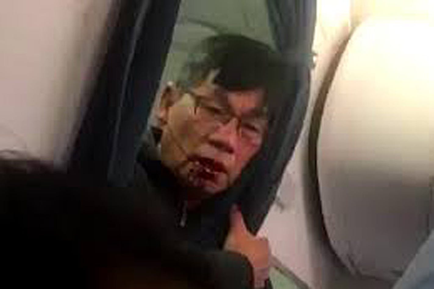 David Dao is shown during an incident on a United Airlines flight in a YouTube video.