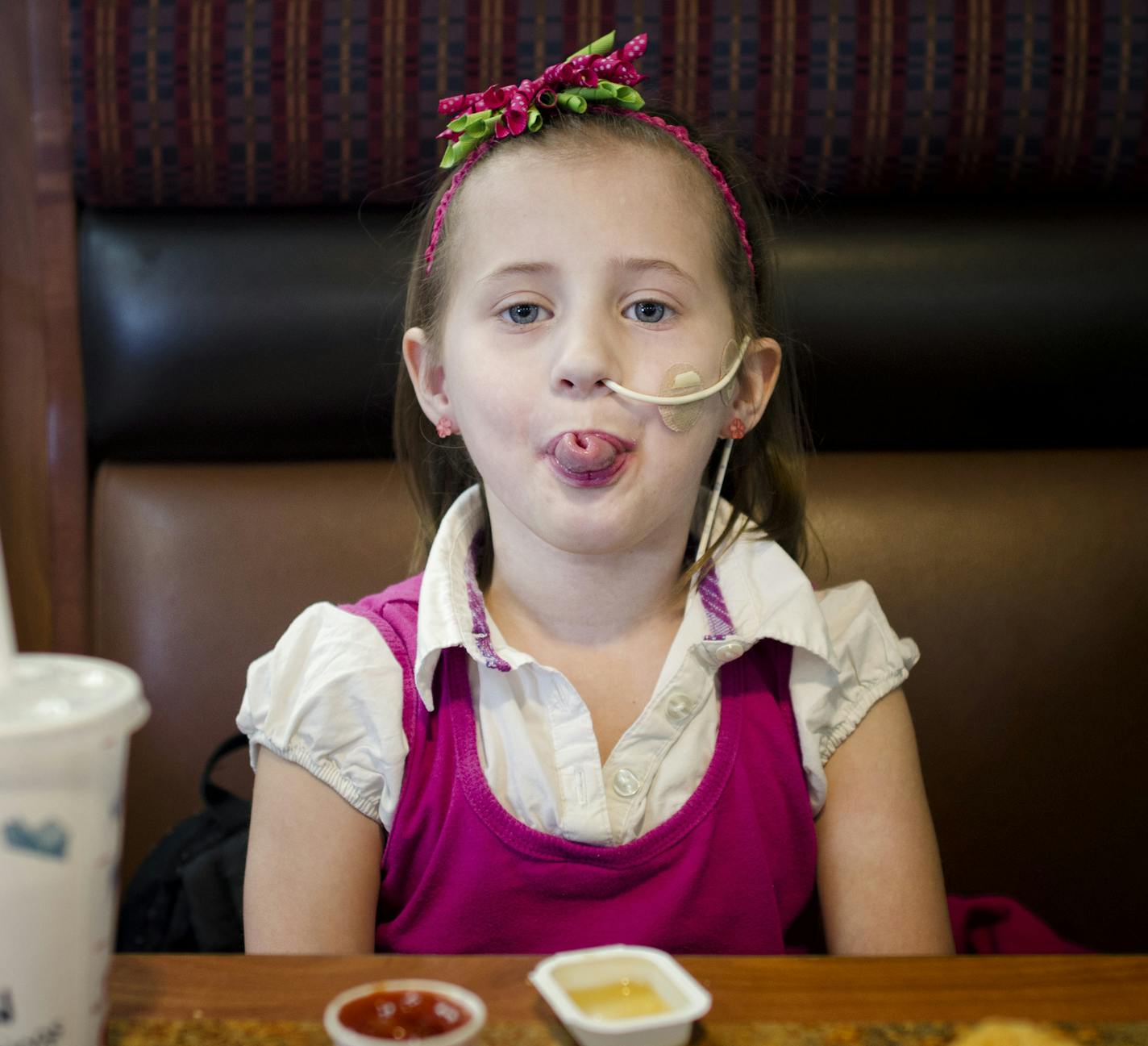 Jocelyn showed off how she can roll her tongue while she enjoyed her favorite meal at McDonalds with mom Kayla after Jocelyn's doctor appointment in Willmar. Jocelyn has a nasogastric tube, used for feeding and administering medication. Chemotherapy sometimes makes it difficult for Jocelyn to eat. The Minnesota Supreme Court last week ruled that a family of a six-year-old with terminal cancer may sue the doctor who failed to issue a timely diagnosis in a ruling that transforms medical malpractic