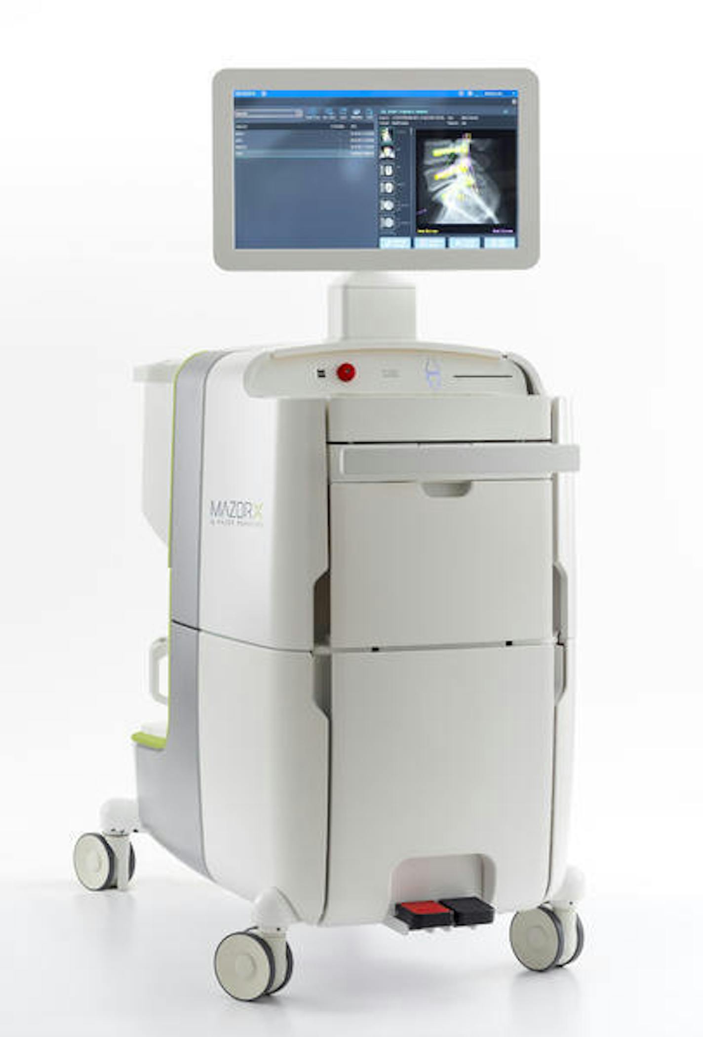 The Mazor X system, at $850,000, is slated to go on sale this fall.