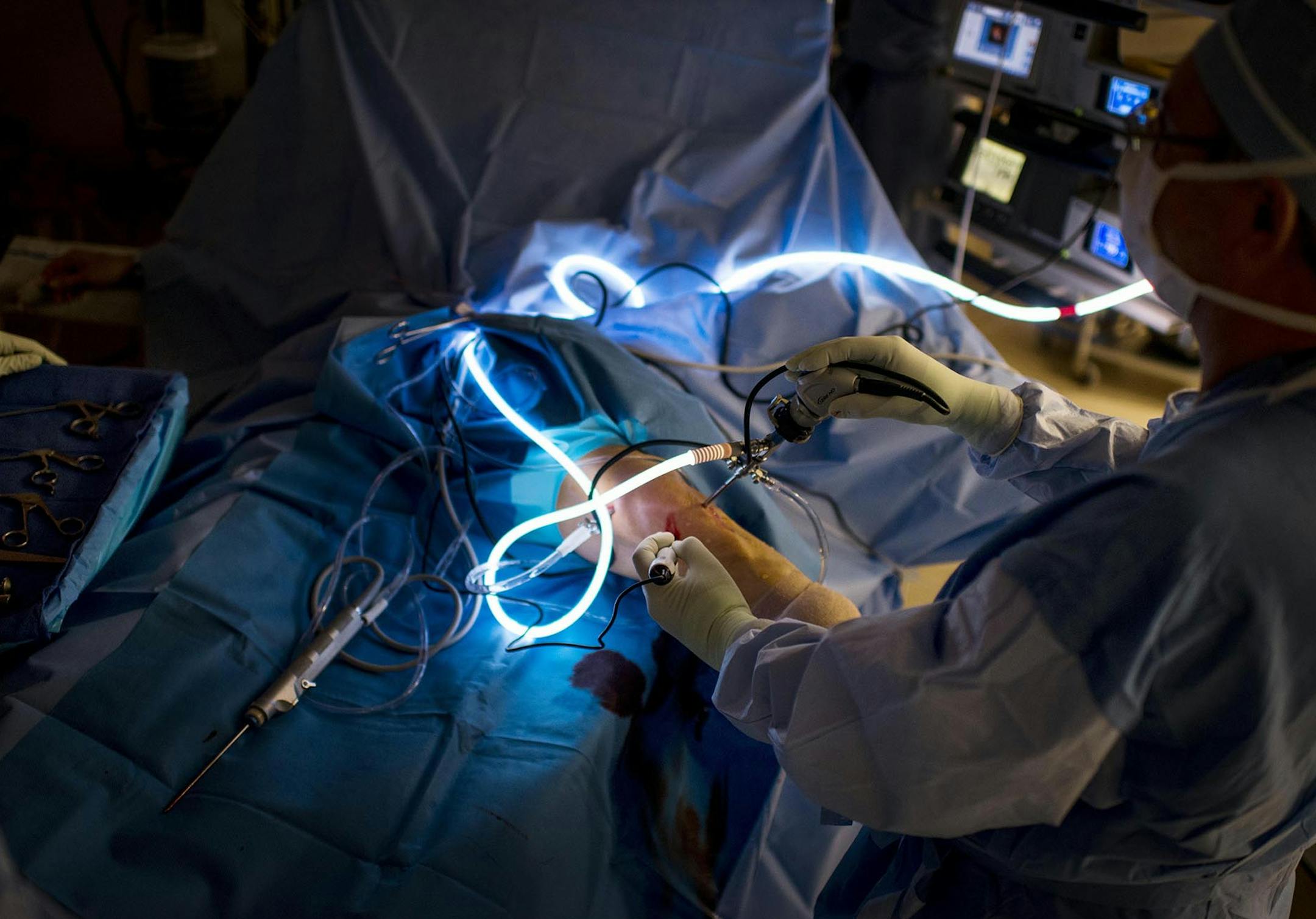 Orthopedic surgeon Eric Guidi uses arthroscopic instruments to repair a torn meniscus at the Massachusetts Avenue Surgery Center. Illustrates SURGERY-CENTERS (category l), by Sandra G. Boodman, special to The Washington Post. Moved Monday, December 15, 2014. (MUST CREDIT: Washington Post photo by Melina Mara.)