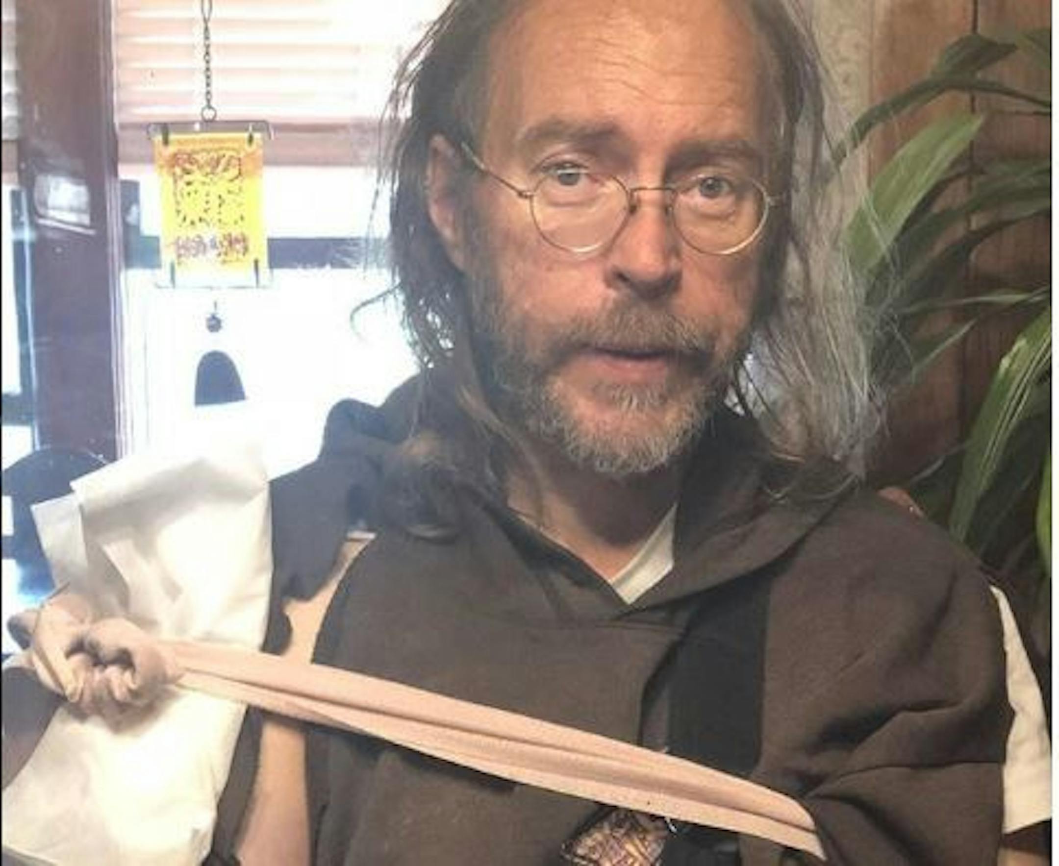 Charlie Parr's post-injury photo from his Instagram page. / @Charlie.Parr