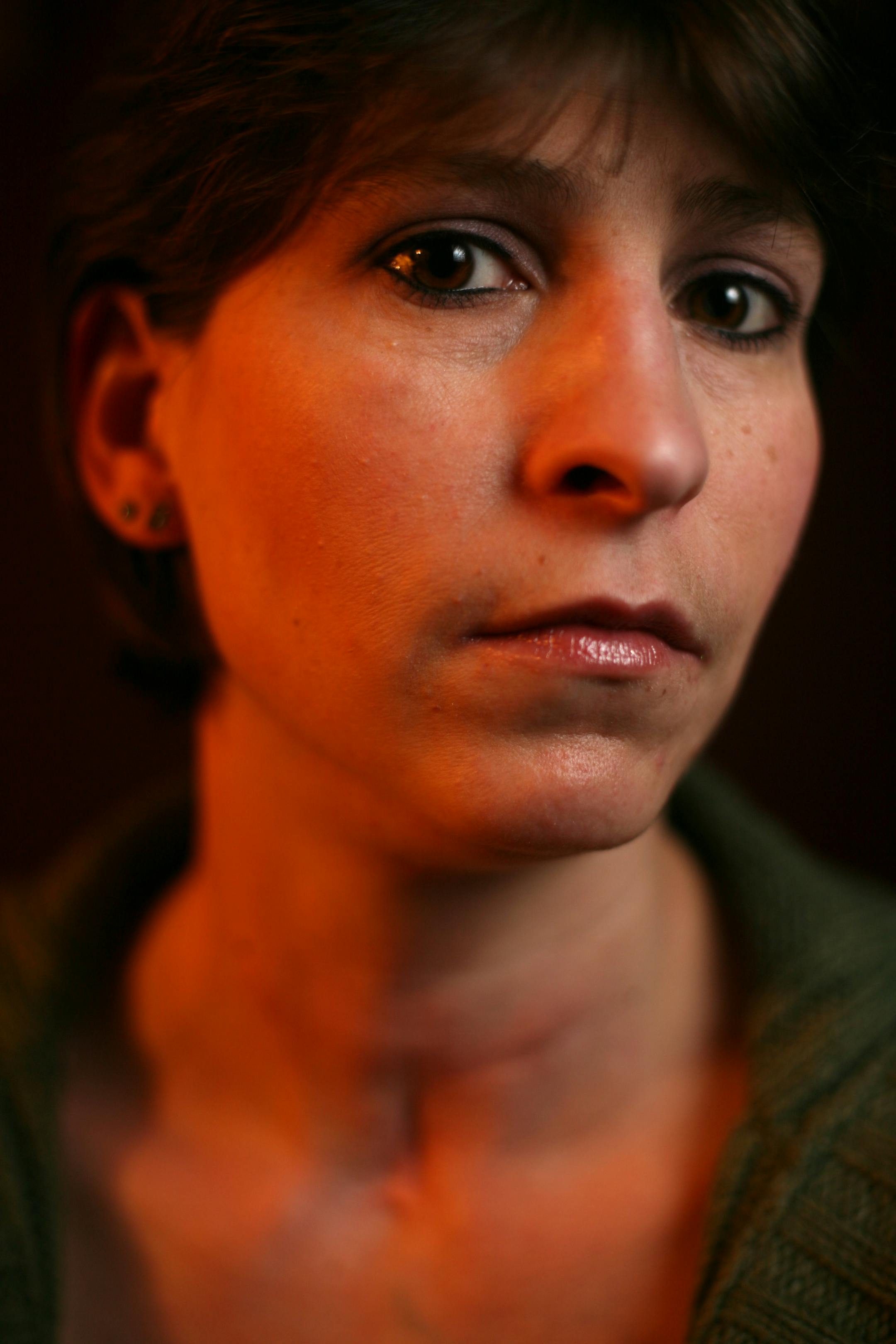 Paula Ybarra-Provost's neck bears the scars from a dog attack in March of last year as well as the tracheostomy she needed as a result of the attack.