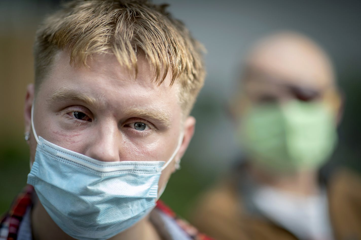 Ethan Marks, left, and Soren Stevenson, right, were shot in the face by Minneapolis police with non-lethal projectiles in the wake of George Floyd's death in police custody on May 25. Each has filed a lawsuit against the city of Minneapolis and unidentified police officers.