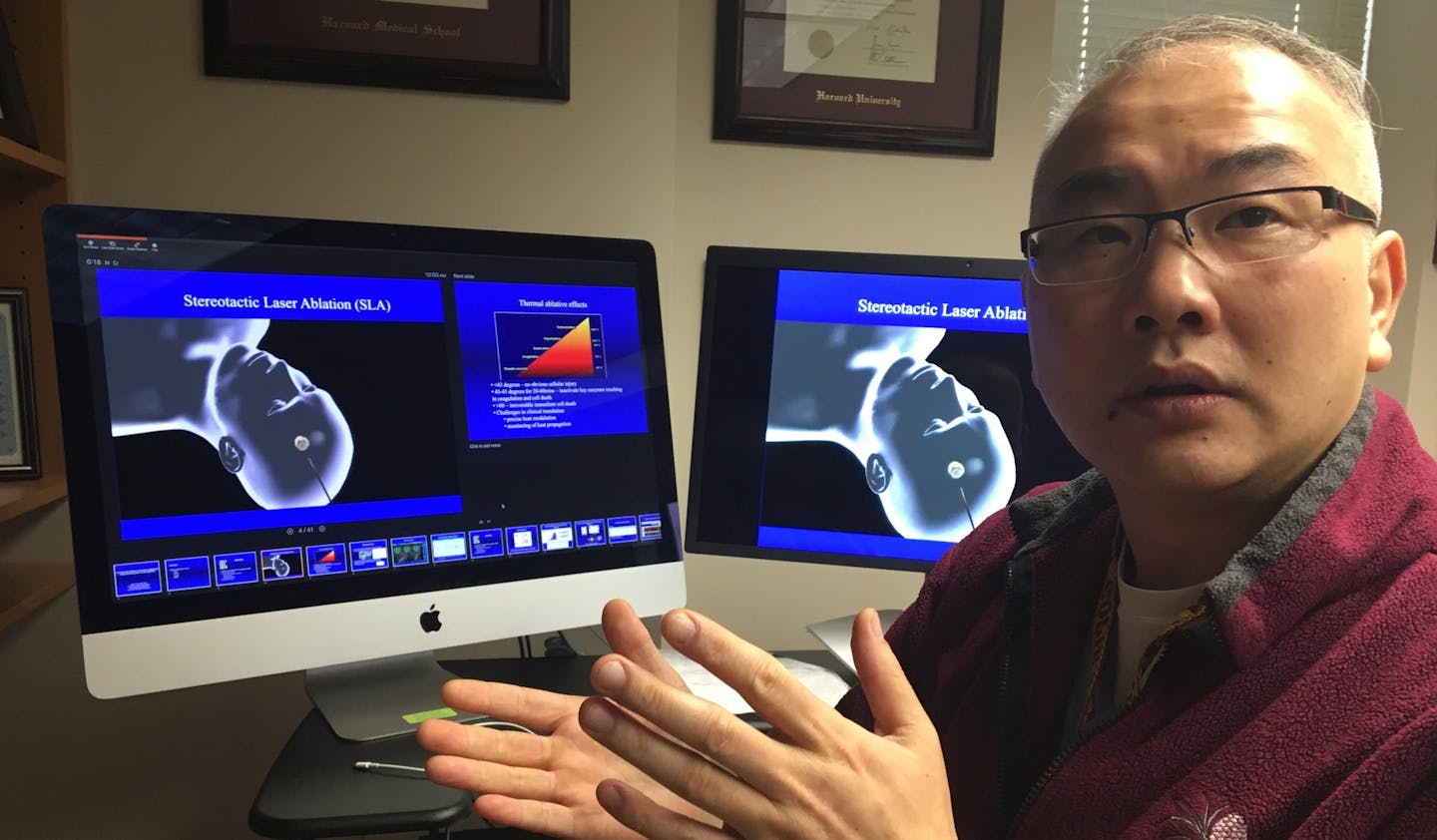 Dr. Clark Chen, a neurosurgeon at the University of Minnesota, uses a device made by Monteris Medical to remove tumors from the brain stem.