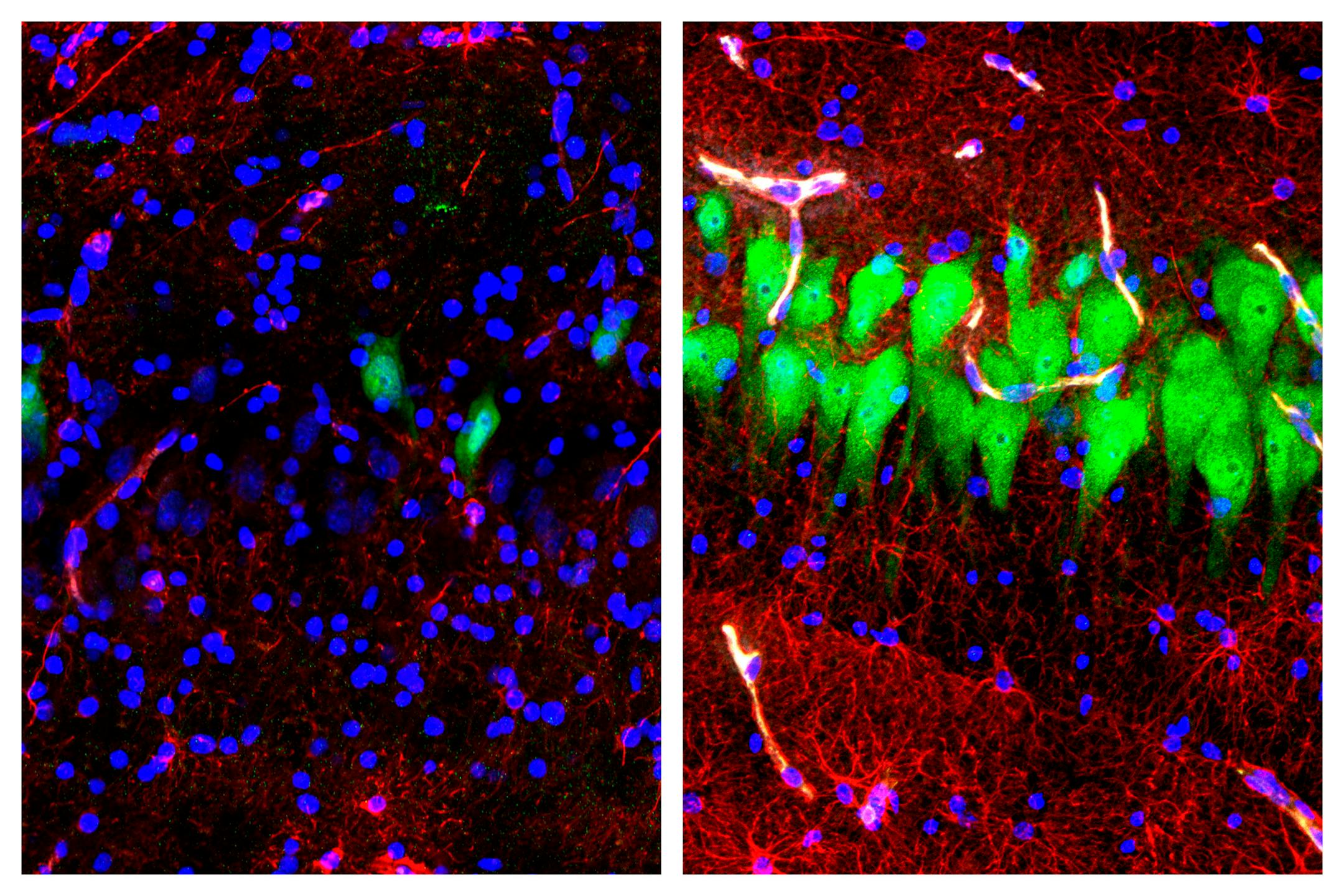 This combination of images provided by the Yale School of Medicine in April 2019 shows stained microscope photos of neurons, green; astrocytes, red, and cell nuclei, blue, from a pig brain left untreated for 10 hours after death, left, and another with a specially designed blood substitute pumped through it. By medical standards "this is not a living brain," said Nenad Sestan of the Yale School of Medicine, one of the researchers reporting the results April 17, 2019, in the journal Nature. But t