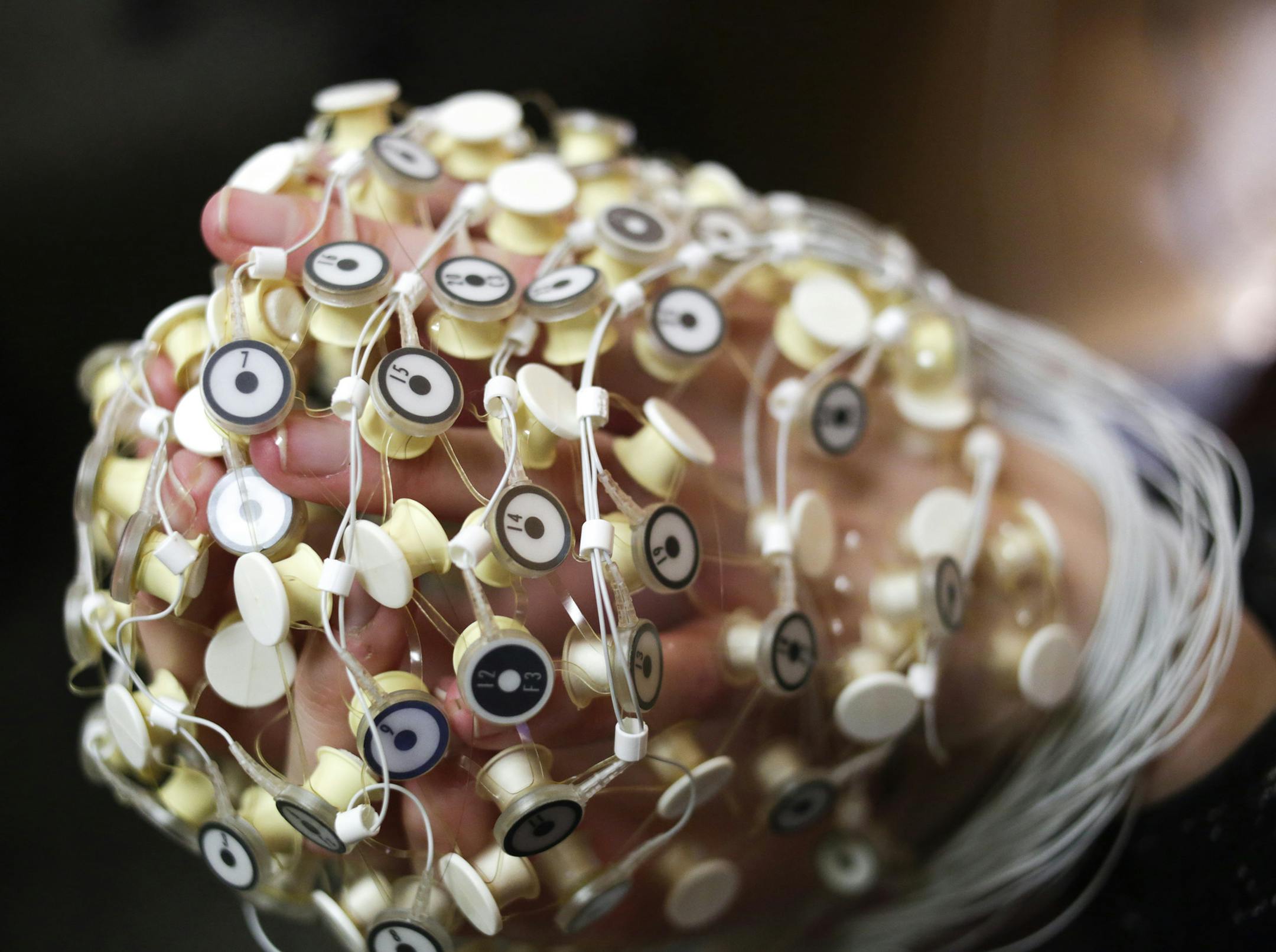 A close up of brain sensors are seen on Tuesday, Jan. 5, 2016, at Athletico in Chicago. (Kristen Norman/Blue Sky/Chicago Tribune/TNS)