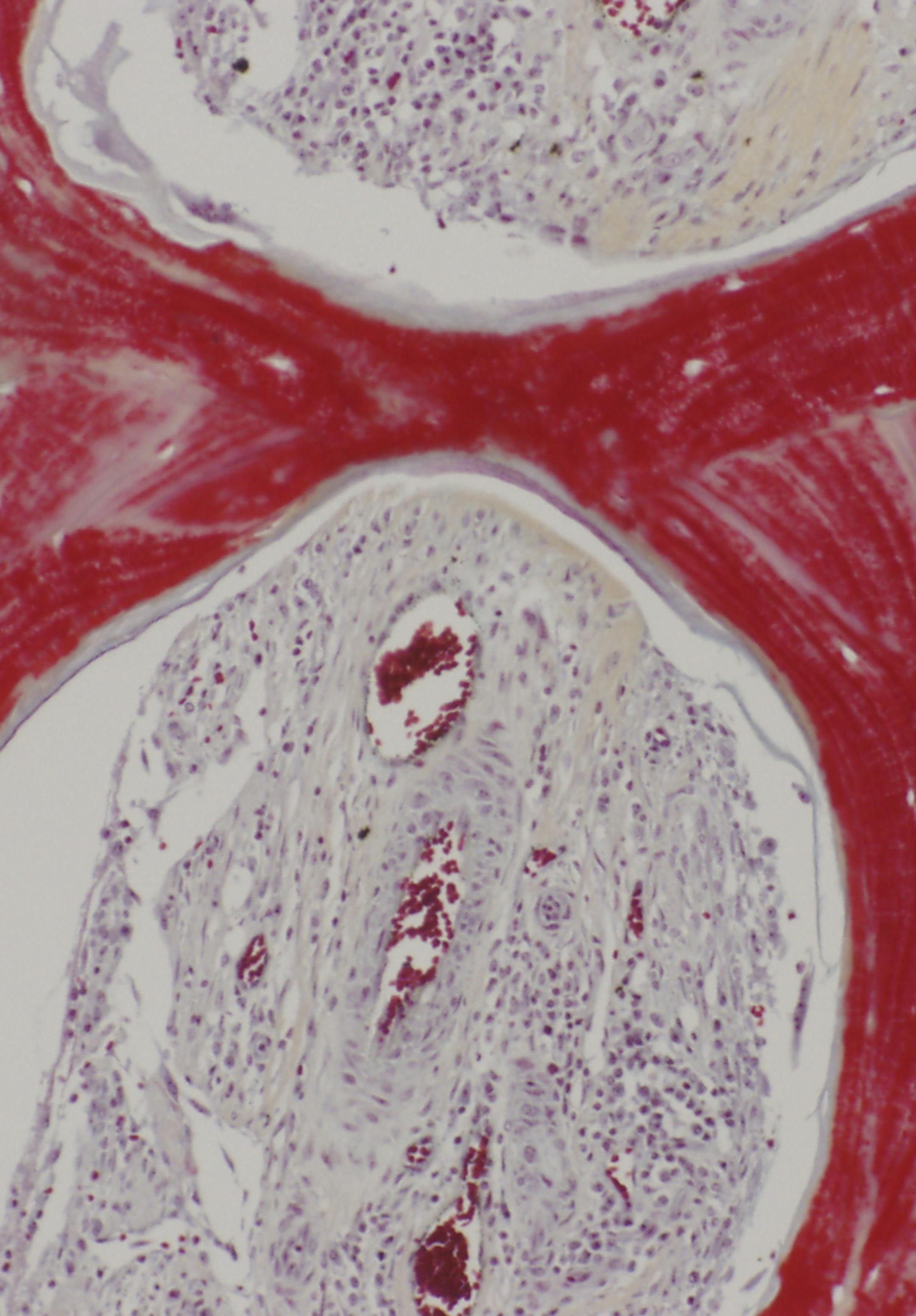 An undated image provided by Sarindr Bhumiratana for Columbia Engineering of regenerated bone grown from stem cells. Jaw bones grown in a nutrient solution were implanted in 14 animals, who are now doing fine. (Sarindr Bhumiratana/Columbia Engineering via The New York Times) -- NO SALES; FOR EDITORIAL USE ONLY WITH SCI-WATCH BY NICHOLAS BAKALAR FOR JUNE 28, 2016. ALL OTHER USE PROHIBITED. --