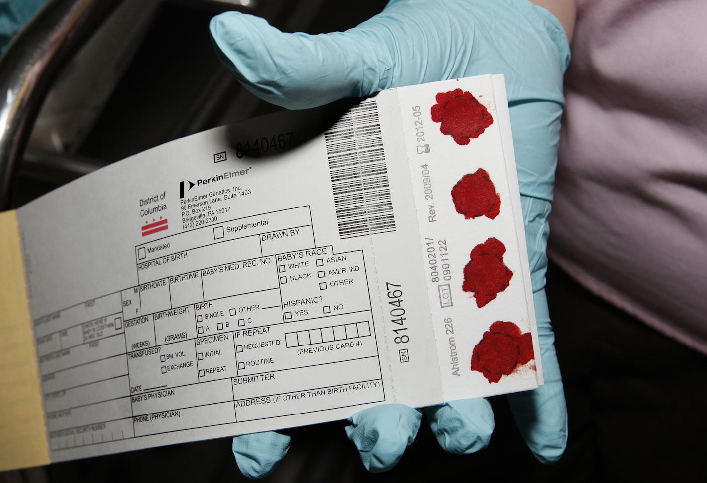 A card is displayed after checking a 1-day-old baby boy for a newborn screening to detect phenylketonuria (PKU) and many other disorders at the Washington Hospital Center in Washington, Friday, Feb. 5, 2010. A critical safety net for babies _ that heelprick of blood taken from every newborn _ is facing an ethics attack. States increasingly are storing the leftover blood samples for later medical research, often without parents' knowledge or consent _ prompting lawsuits in two states and work in