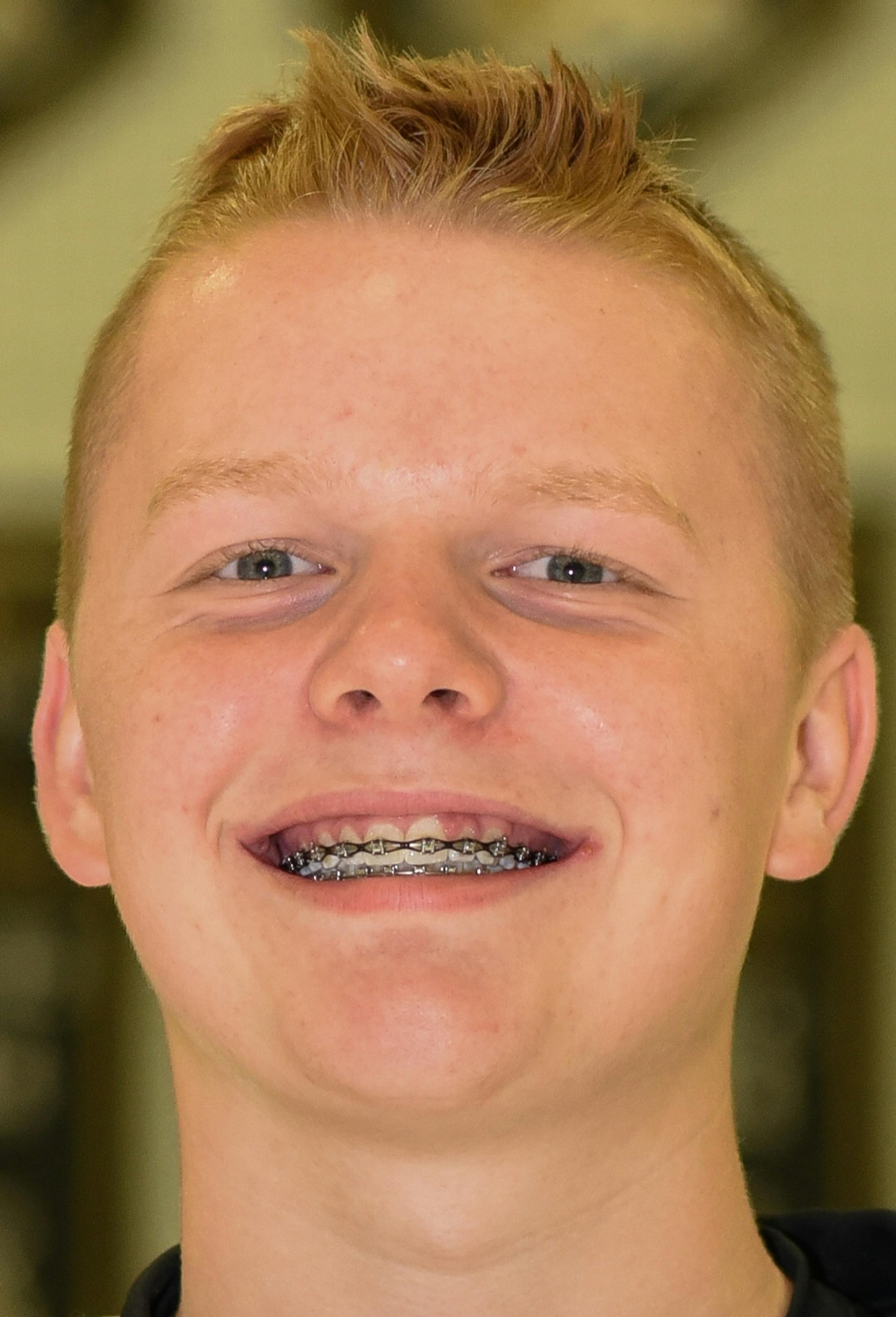 Nick Dainty, Andover hockey, soph., 2016-17