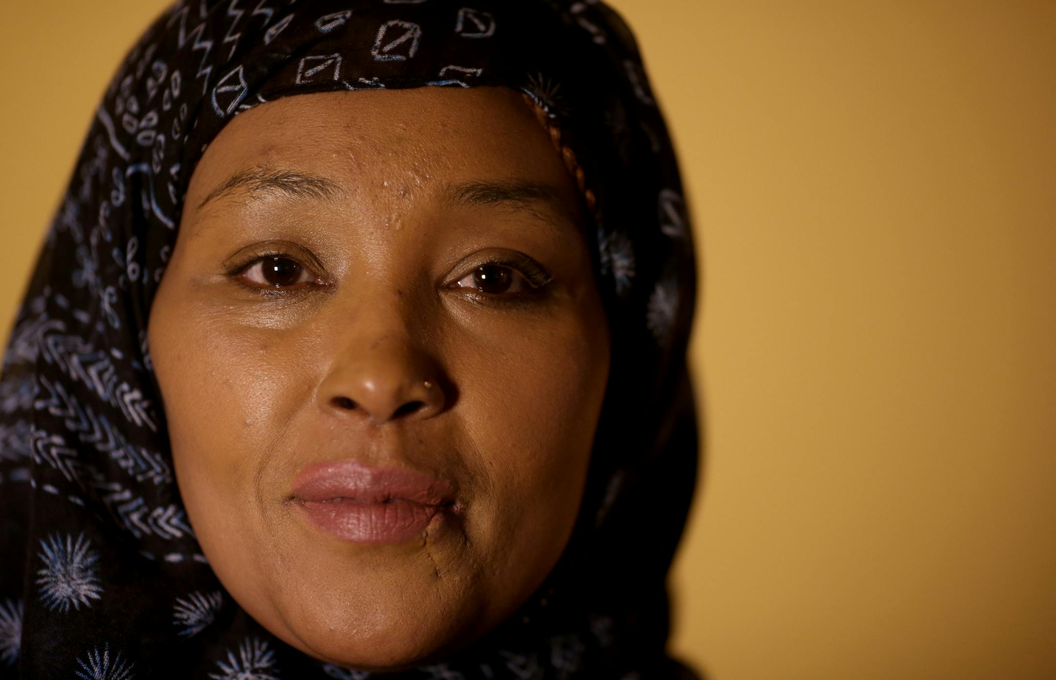 Asma Jama said she lives with fear after being attacked at a restaurant in Coon Rapids Oct. 30.