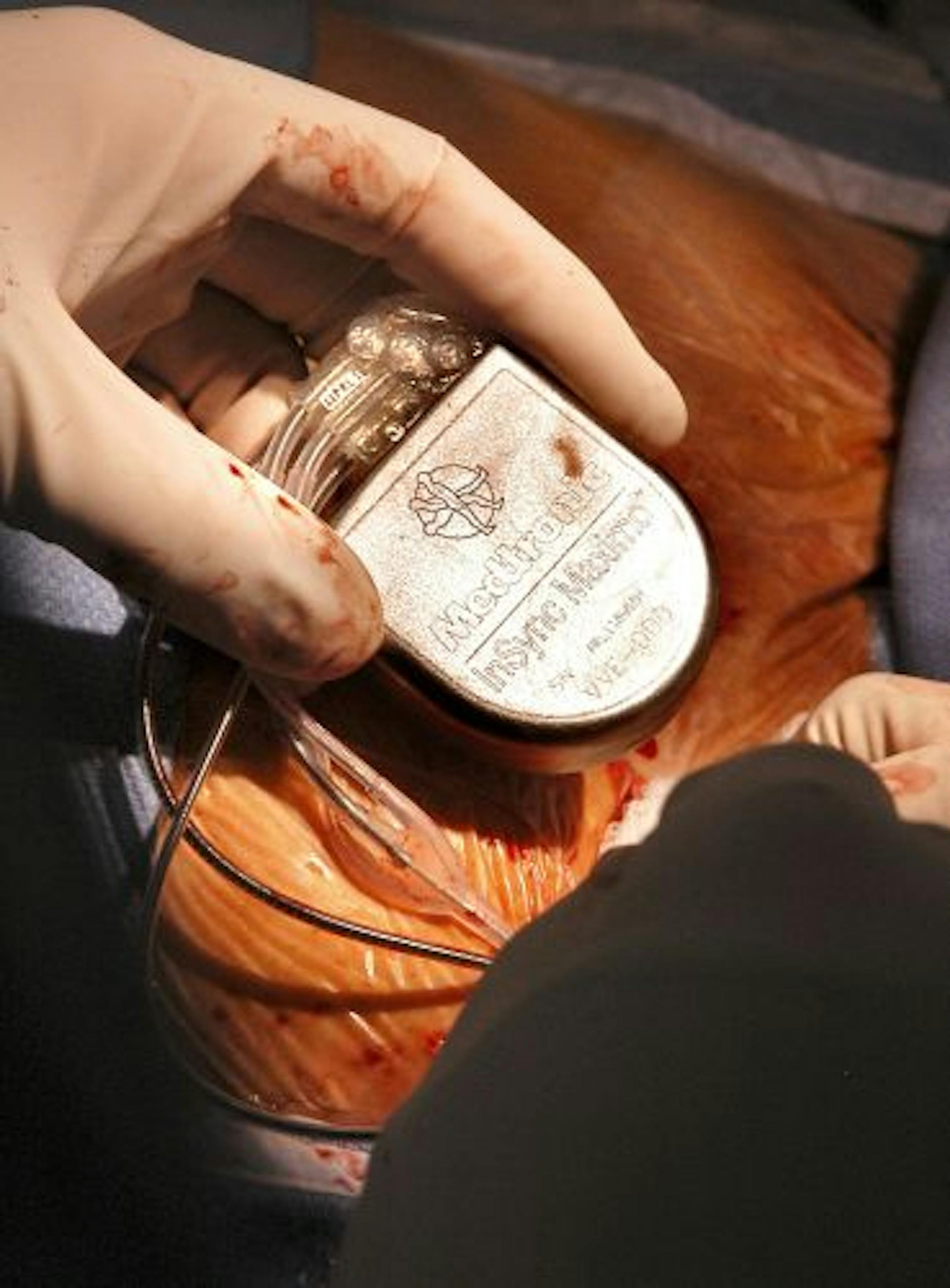 Doctors fastened leads to a heart defibrillator. The industry says the Medical Device Safety Act would hamper innovation and treatment.