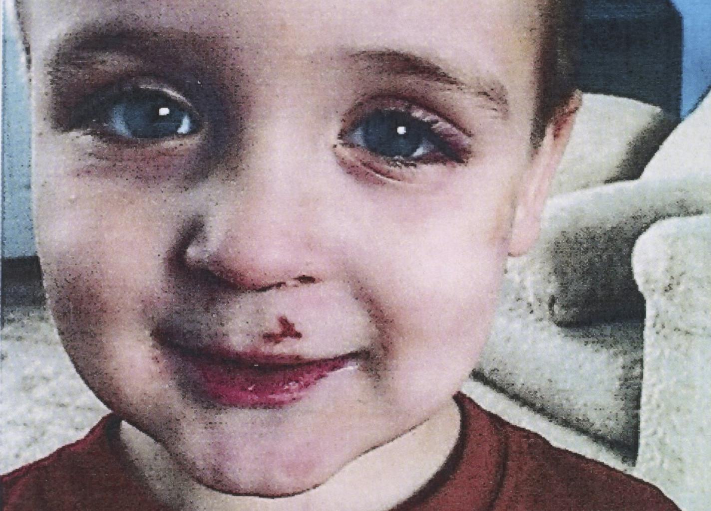 On 15 occasions, day-care workers and others told Pope County authorities that they suspected Eric Dean was being hurt. But it was not enough. His death exposed the failure of a system charged with protecting the youngest Minnesotans. This photo was taken by his teacher, Mindy DeGeer. It was presented by the prosecution as evidence during the May 2014 trial of Amanda Peltier in the death of her stepson, Eric Dean.