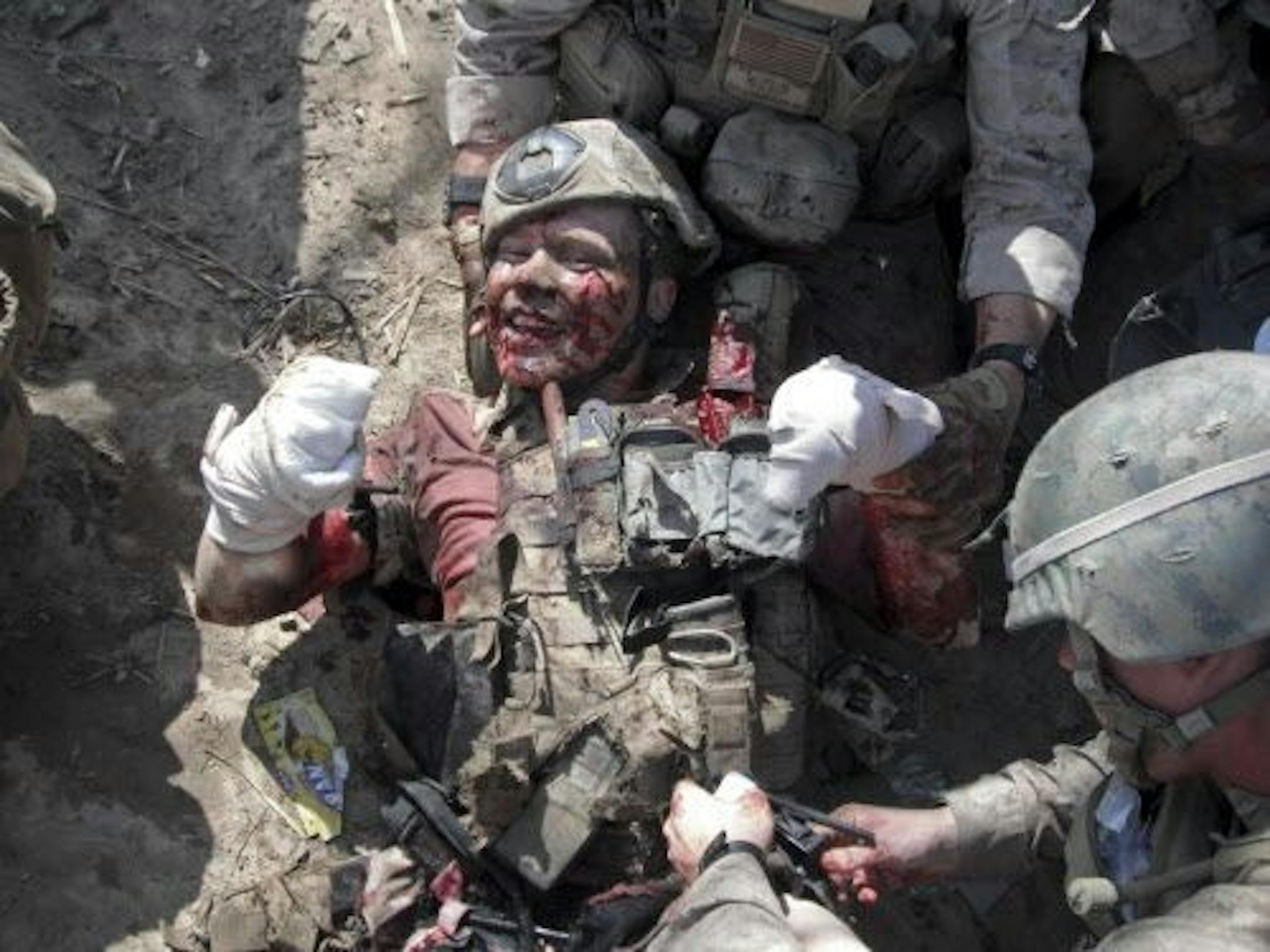 In this photo taken in 2011 and provided by Eric Lunson, Marine Gunnery Sgt. Brian Meyer smiles for a picture by another Marine while waiting to be evacuated after a bomb he was trying to deactivate exploded in Afghanistan.