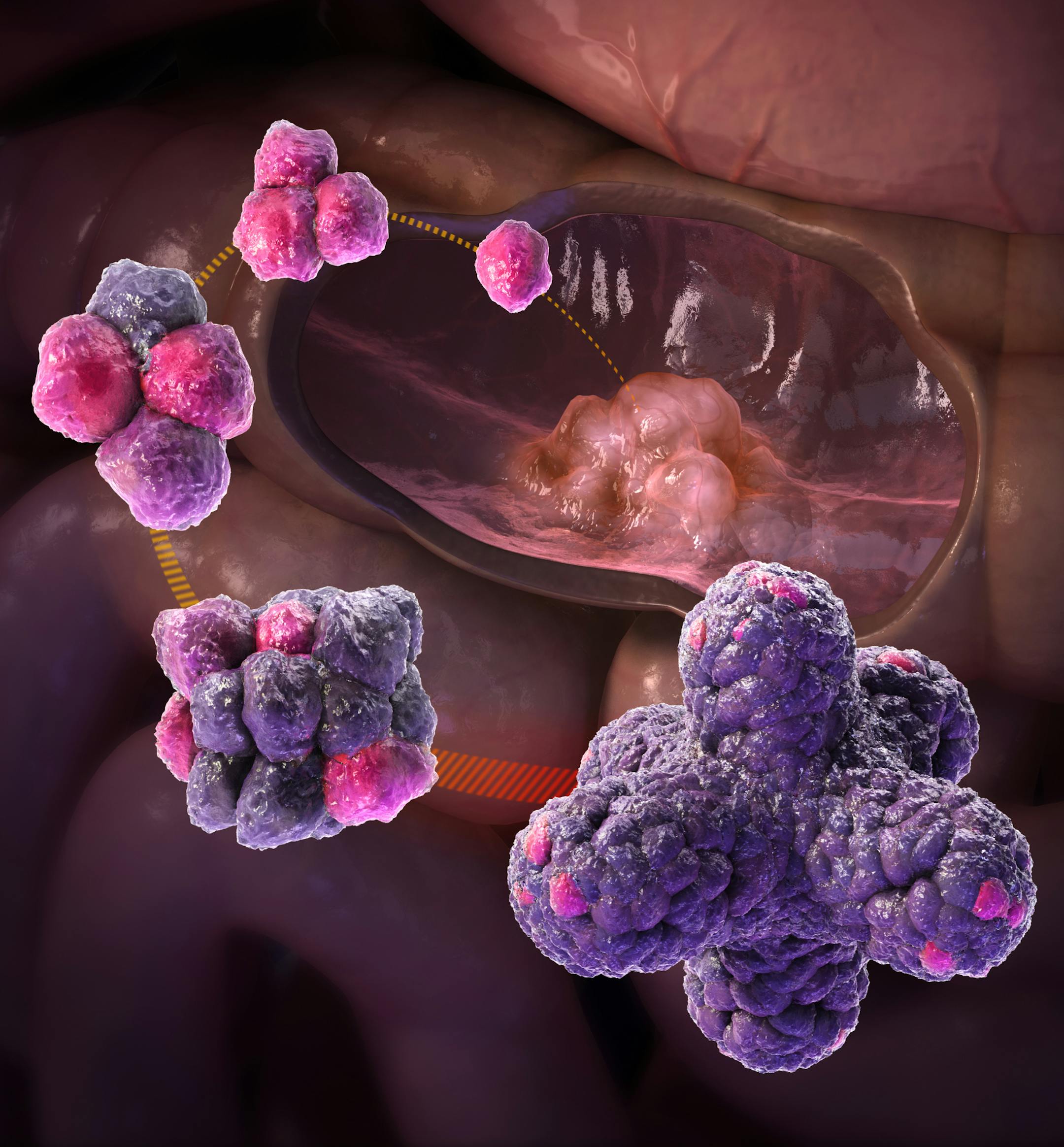 This illustration provided by the Hubrecht Institute in Utrecht, Netherlands shows organoids (mini organs), created from the intestinal tissues of a patient. Doctors in the Netherlands are aiming to grow mini intestines for every Dutch cystic fibrosis patient to figure out what drugs might work for them. (Hubrecht Institute via AP)