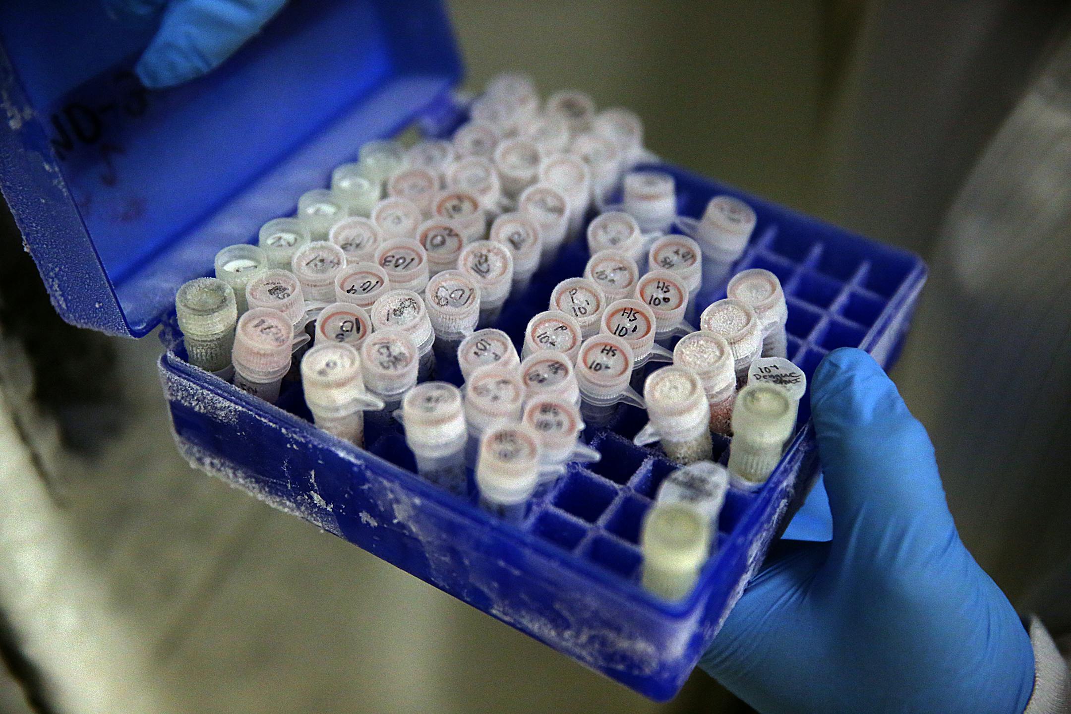 Susan Belzer, vice president of Diagnostics at MD Biosciences, held samples of the Zika virus used by scientists at the firm to develop a test for the virus. The Zika virus samples are stored at -80 Centigrade. ] JIM GEHRZ ï james.gehrz@startribune.com /St. Paul, MN / March 3, 2016 /1:00 PM ñ BACKGROUND INFORMATION: A St. Paul based diagnostics company is racing to develop a reliable assay test to detect the Zika virus in human blood samples. Several companies across the country are do