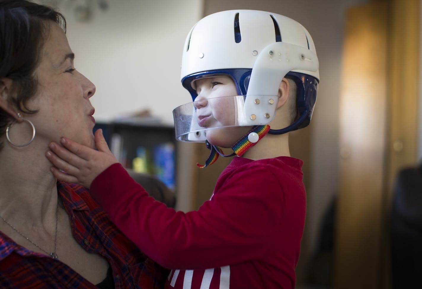 Wyatt Hauser cupped his mother&#x2019;s chin in his hand while looking into her eyes and sitting on her lap at home on Wednesday, February 3, 2016 in Woodbury, Minn.