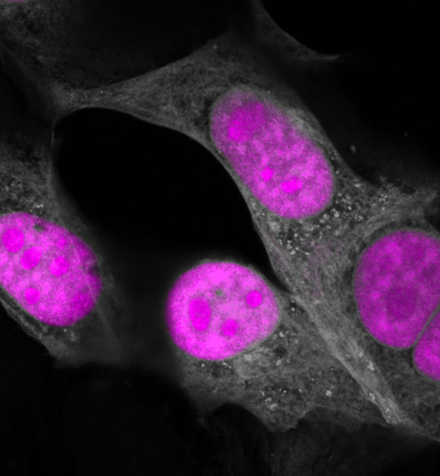 CasRx (magenta) targeting RNA in the nuclus of human cells (gray). (Salk Institute)