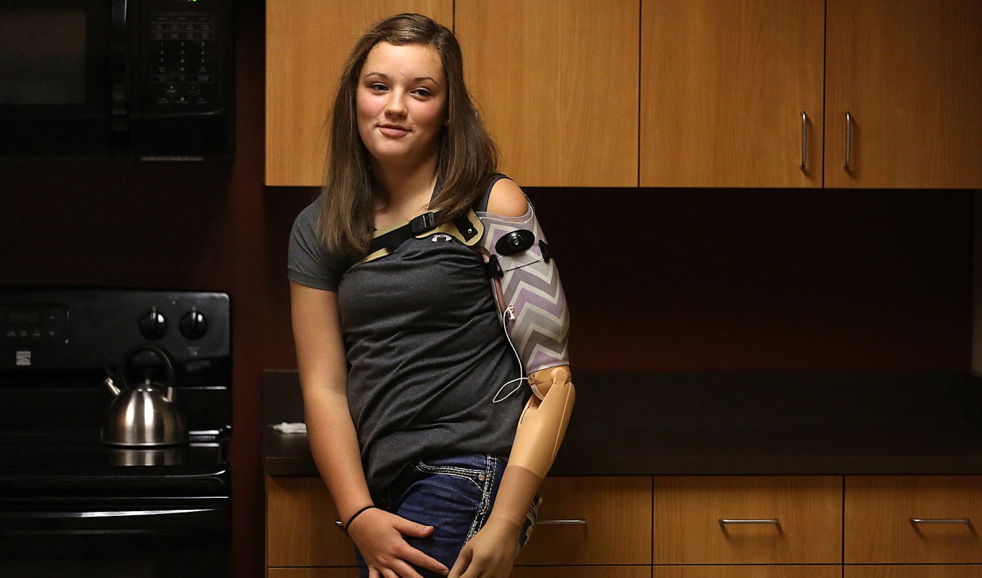 Thirteen-year-old Kate Jorgenson practiced using her new-age, prosthetic arm during a physical therapy session in Maple Grove. ] JIM GEHRZ &#xef; james.gehrz@startribune.com / Maple Grove, MN / September 16, 2015 / 10:00 AM BACKGROUND INFORMATION: A 13-year-old girl has reached a milestone as the youngest patient in the world to receive a new-age prosthetic arm -- one that requires more surgery but results in more connections to nerves and more intuitive and effective motions. On Wednesday, she