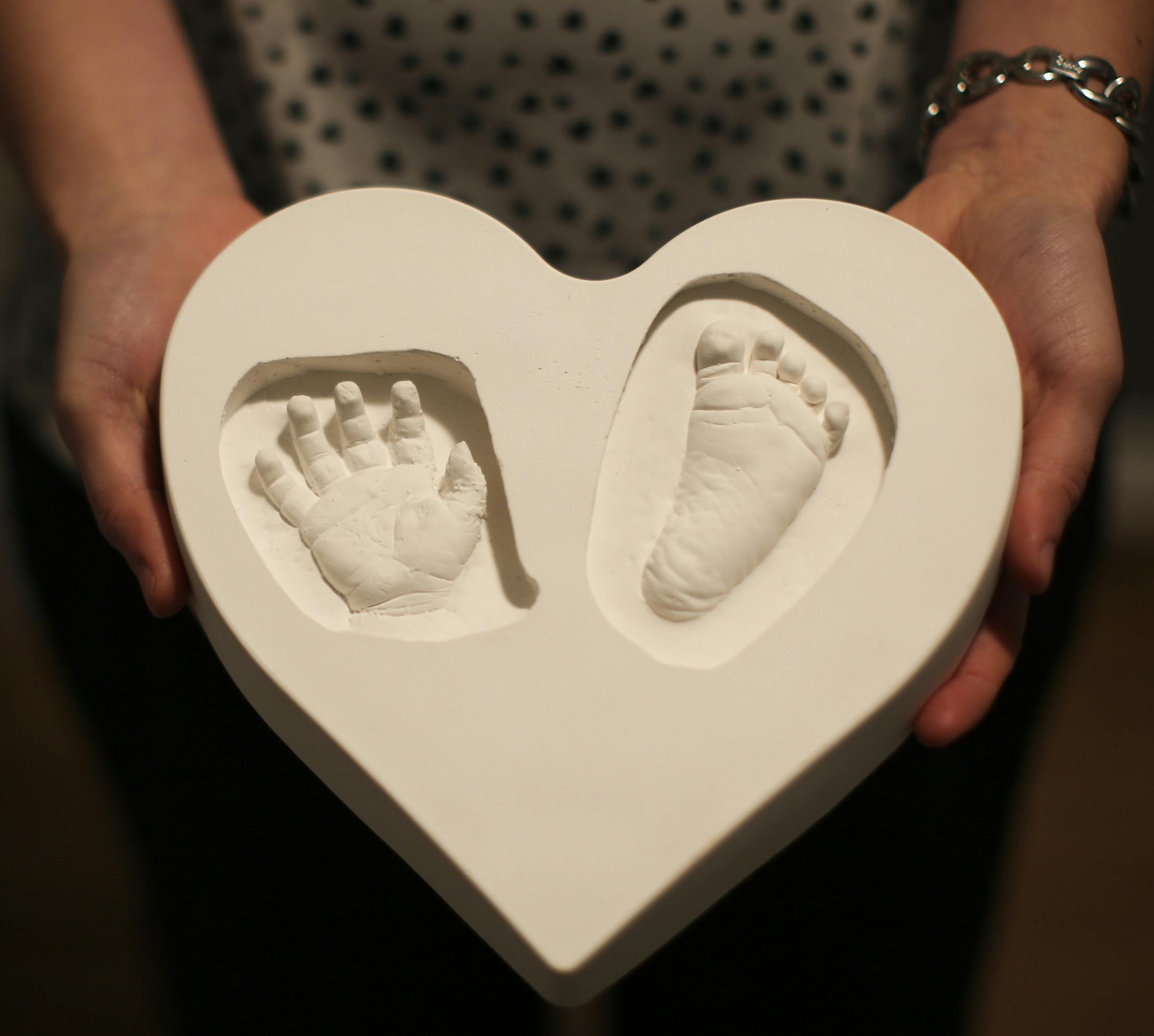 Chris and Amanda Duffy's baby girl Reese was born this November stillborn. The hospital made moldings of her hand and feet for the parents as a keepsake. Photographs taken on Wednesday, March 4, 2015 in Roseville, Minn. ] RENEE JONES SCHNEIDER • reneejones@startribune.com