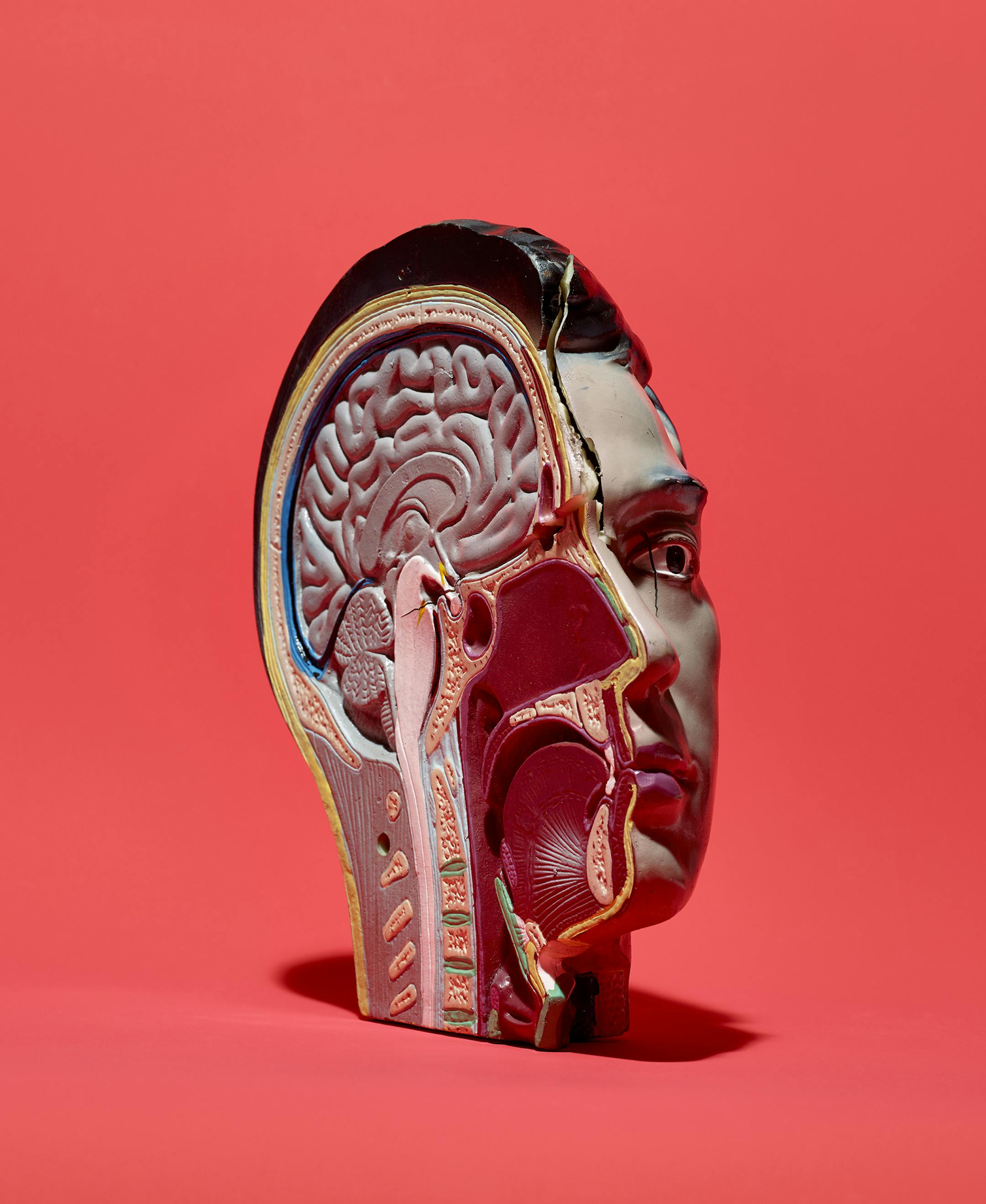 Few drugs have been approved for treatment of Alzheimer’s disease, and none works very well. It has become one of the most intractable problems in medicine. (Jens Mortensen/The New York Times)