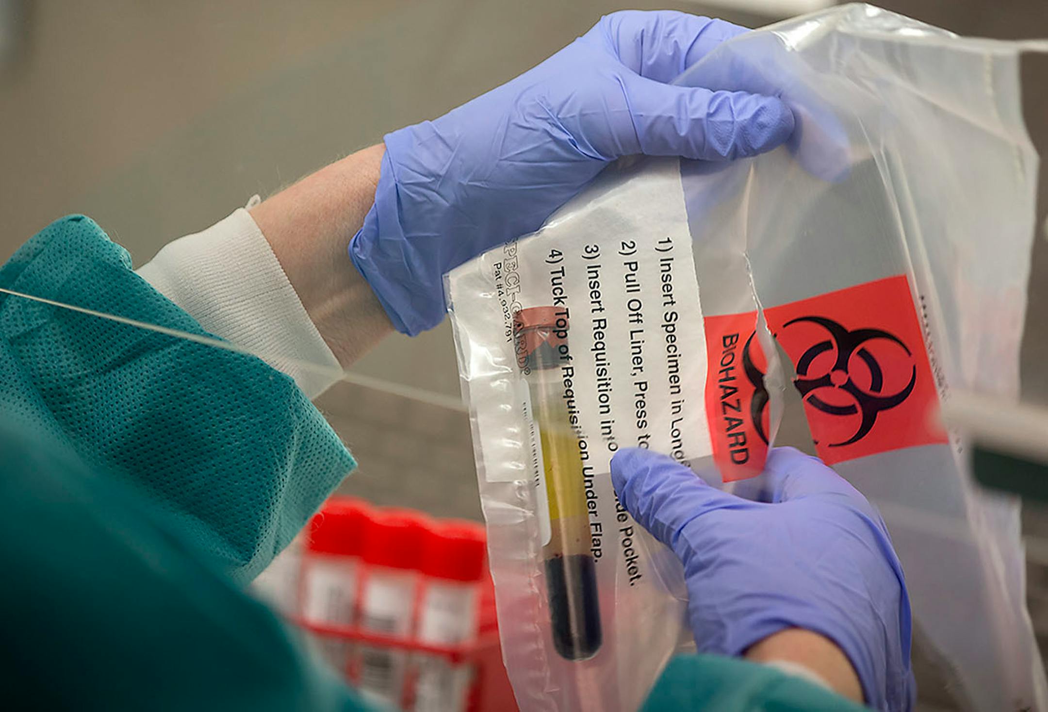 Annette Leduc, a medical laboratory technician for the Minnesota Health Department processes tubes with saliva from patients to test for measles, Thursday, May 11, 2017 at the MHD laboratories in St. Paul, MN.