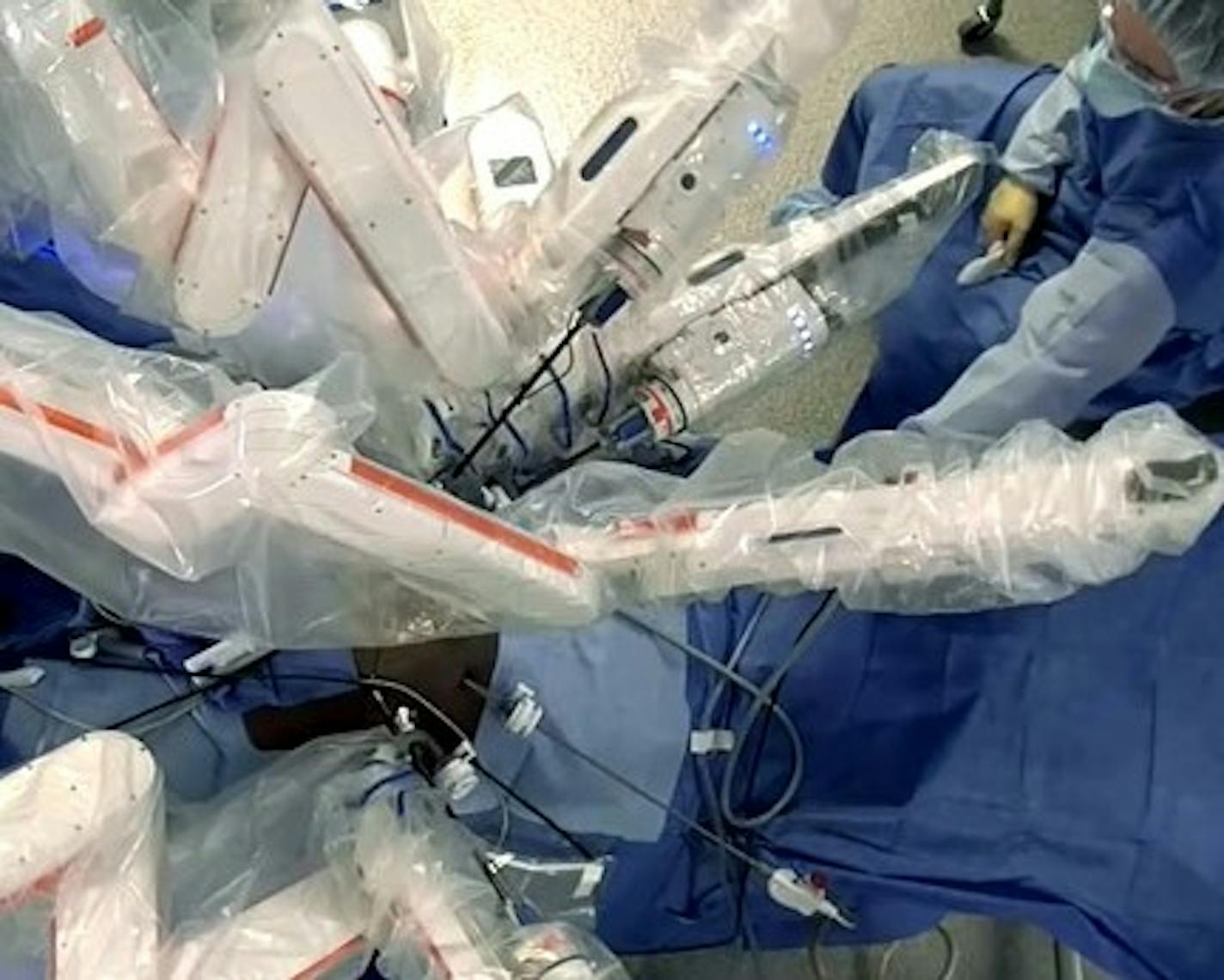 Medtronic on Tuesday introduced the Hugo RAS, its robotic system for soft tissue surgery.