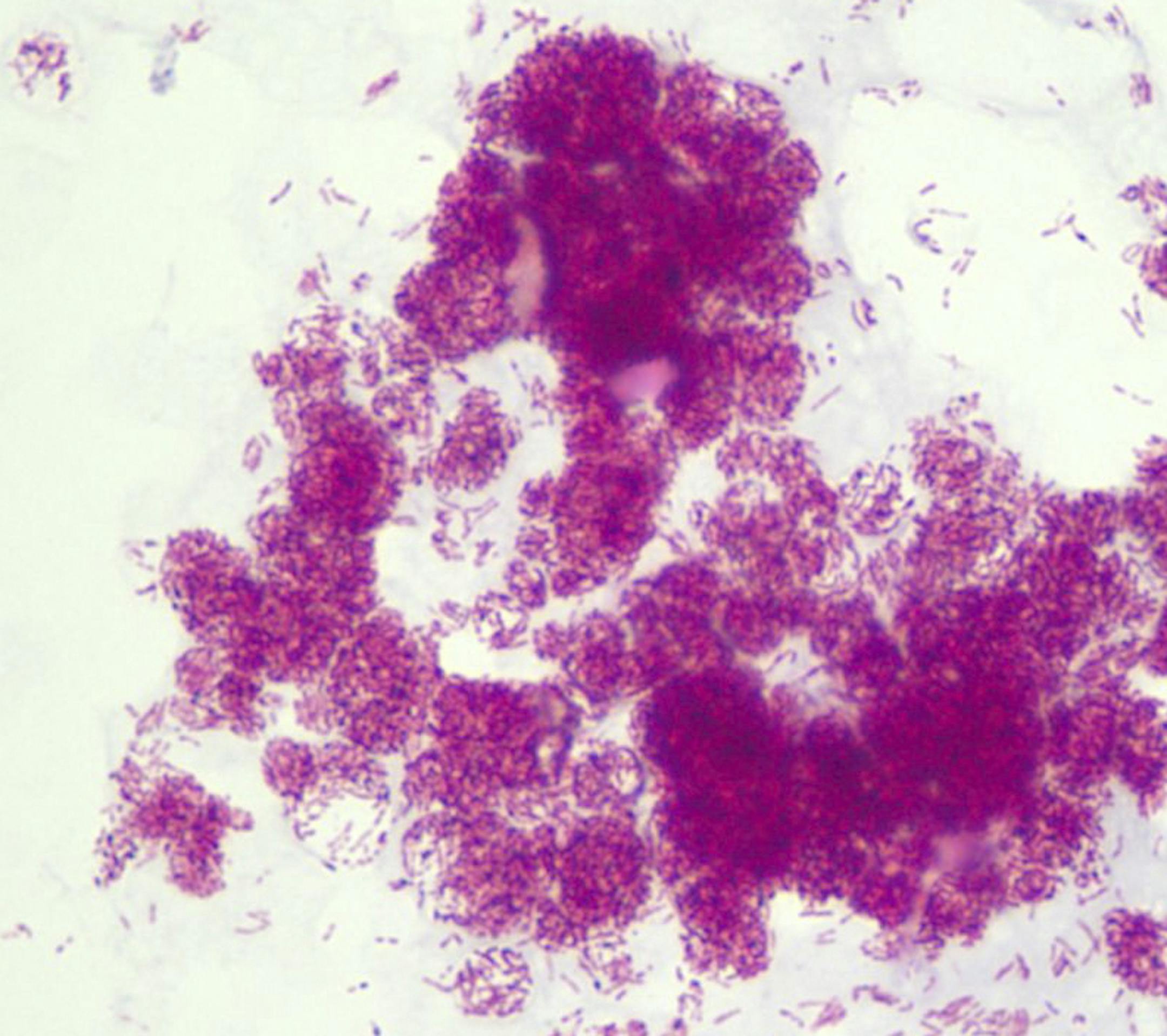 In an undated handout photo, Mycobacterium leprae, the parasite that causes leprosy. At once rugged and feeble, the leprosy bacillus continues to surprise and confound researchers with its staying power. (Dr. Xiang-Yang Han via The New York Times) -- NO SALES; FOR EDITORIAL USE ONLY WITH STORY SLUGGED SCI-LEPROSY BY ANGIER. ALL OTHER USE PROHIBITED.