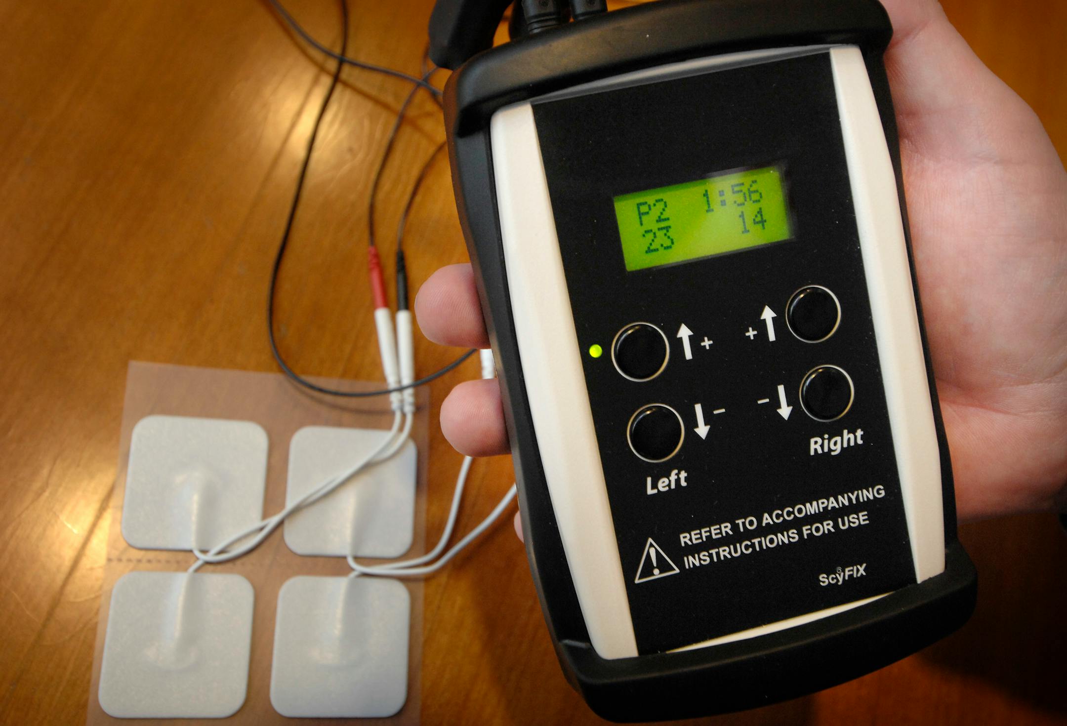 The microcurrent stimulation therapy device developed by ScyFix. ScyFix President Darrell DeMello calls it "the pacemaker for the eye."