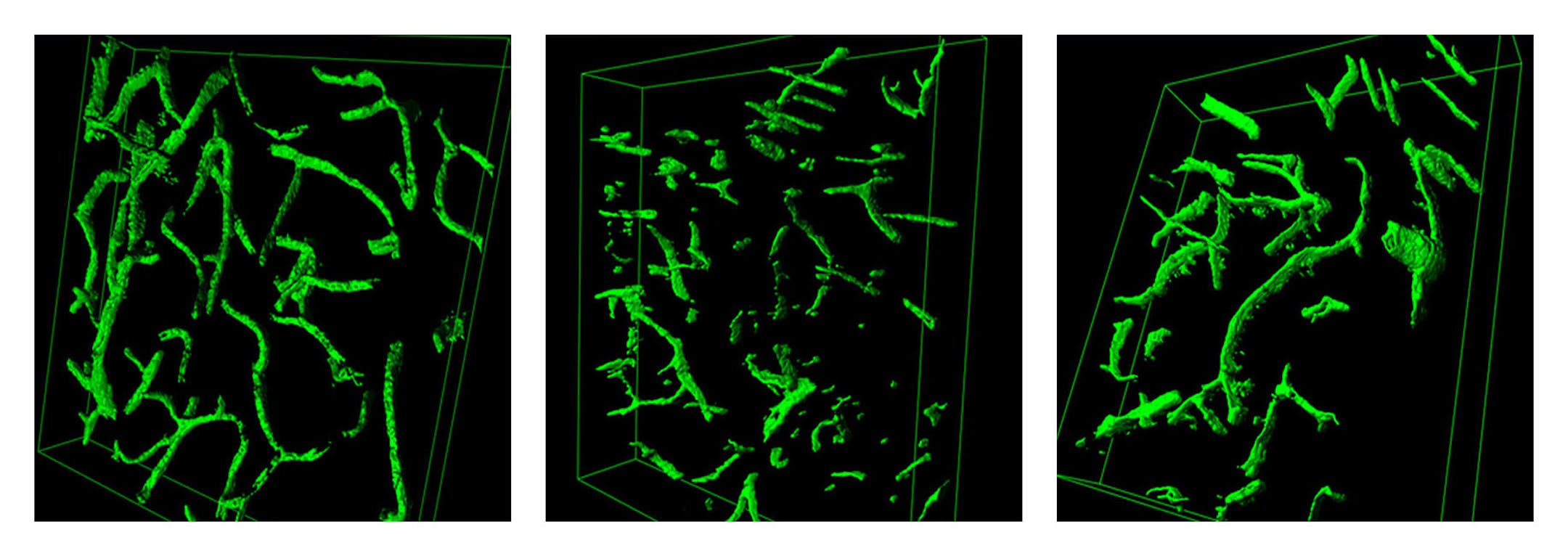 This combination of images provided by Lida Katsimpardi in May 2014 shows 3-D reconstructions of brain blood vessels in, from left, a young mouse, an old mouse, and an old mouse who was exposed to the blood of a young mouse. Older mice got stronger, exercised longer and performed better mentally after they were injected with blood from young mice, or even just with a substance that's more abundant in younger blood according to three papers published online Sunday, May 4, 2014 by the journals Sci