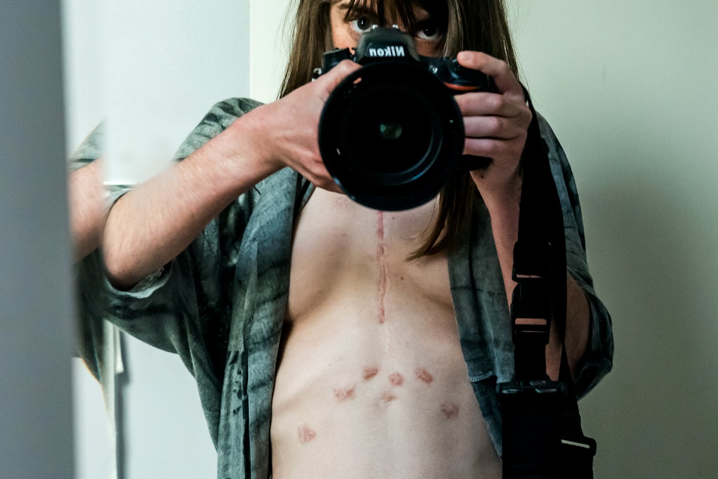 Photographer Kathleen Sheffer takes a photo of herself in a mirror with her shirt unbuttoned, showing a line of scars from a heart and lung transplant.