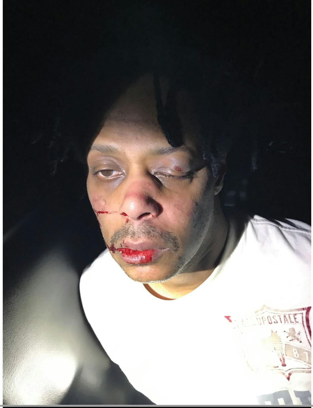 Photos taken by police and later obtained by public defenders show injuries to Andre Moore’s face after a December 2019 traffic stop by Minneapolis police.