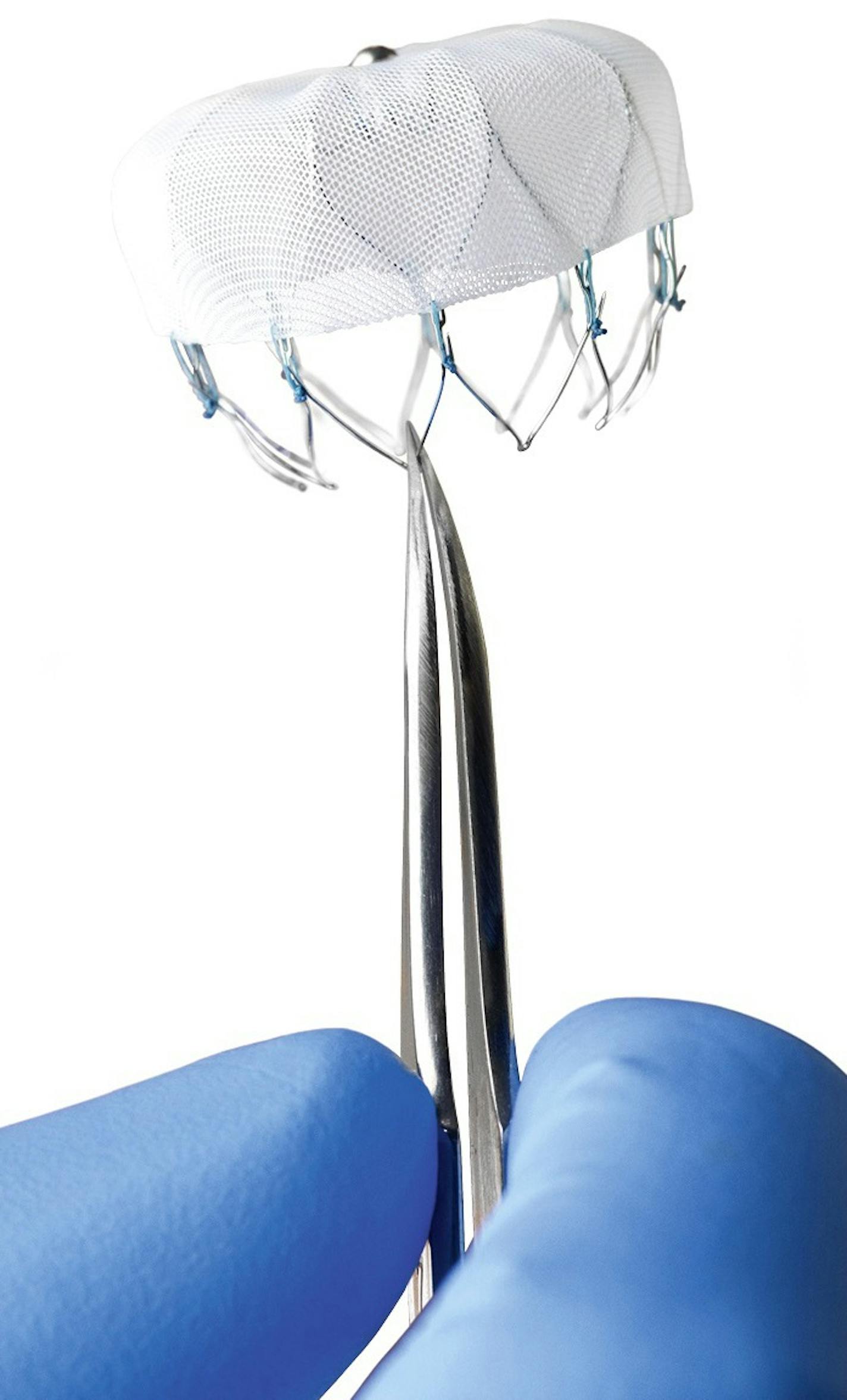 The Watchman Left Atrial Appendage Closure Device from Boston Scientific was developed in the Twin Cities by Aritech, which was bought by Boston. ORG XMIT: MIN1508191016132087