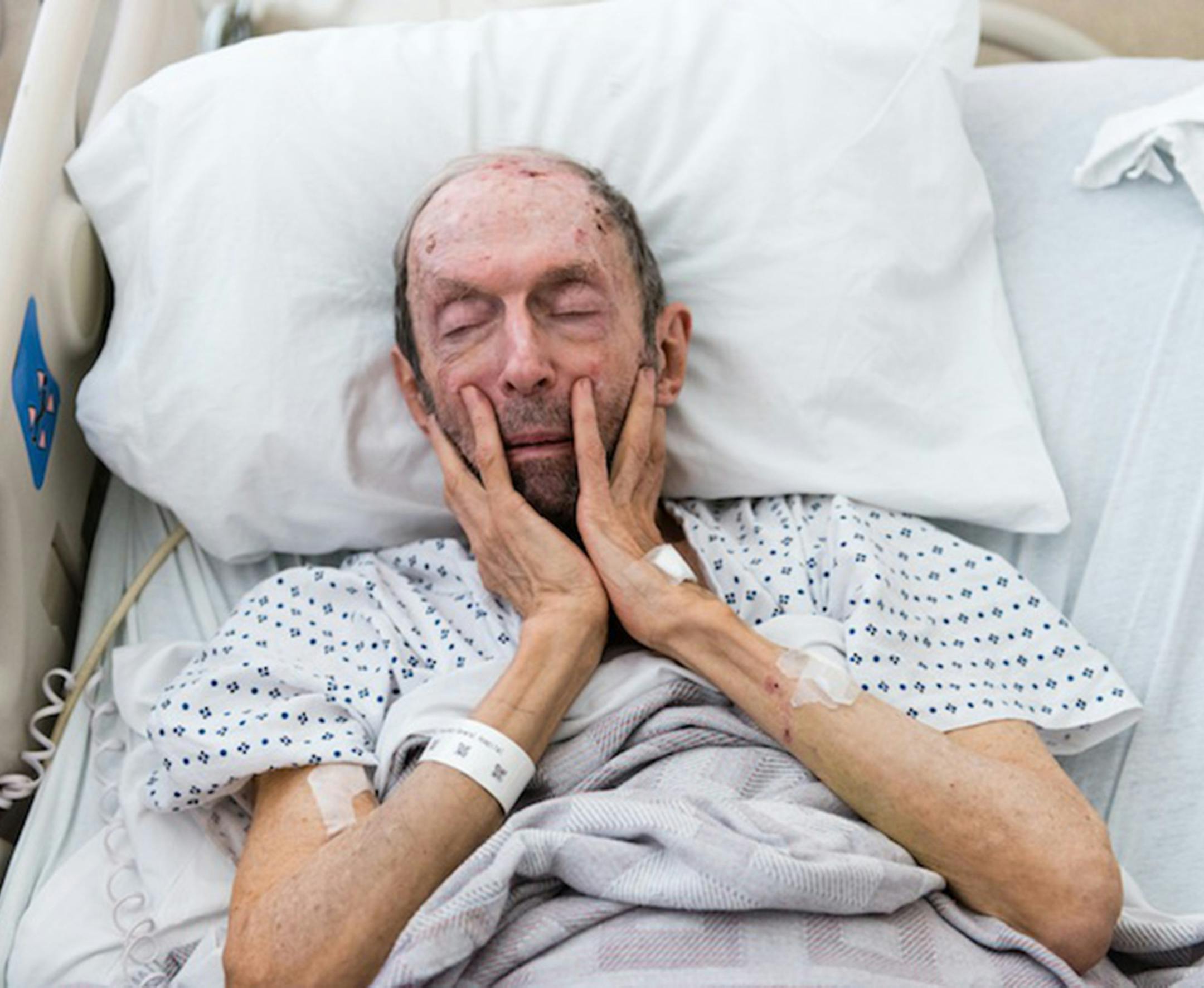 Ron Schwarz, 79, was hospitalized after falling in the shower. Schwarz is a patient in a special ward at the San Francisco General Hospital known as the Acute Care for the Elderly unit, or ACE. (Heidi de Marco/KHN)